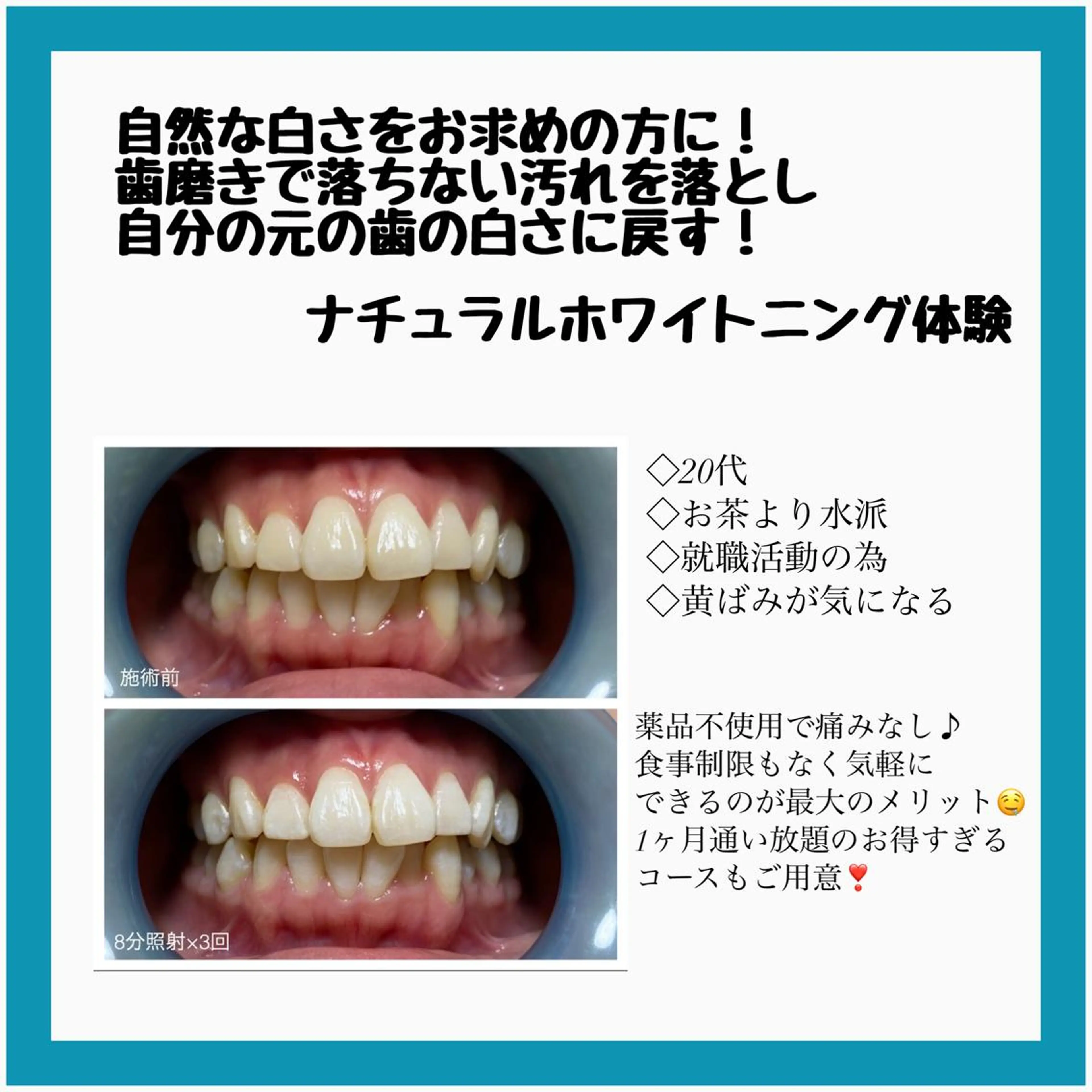 ネイル/耳つぼ /新ホワイトニングのネイルデザイン