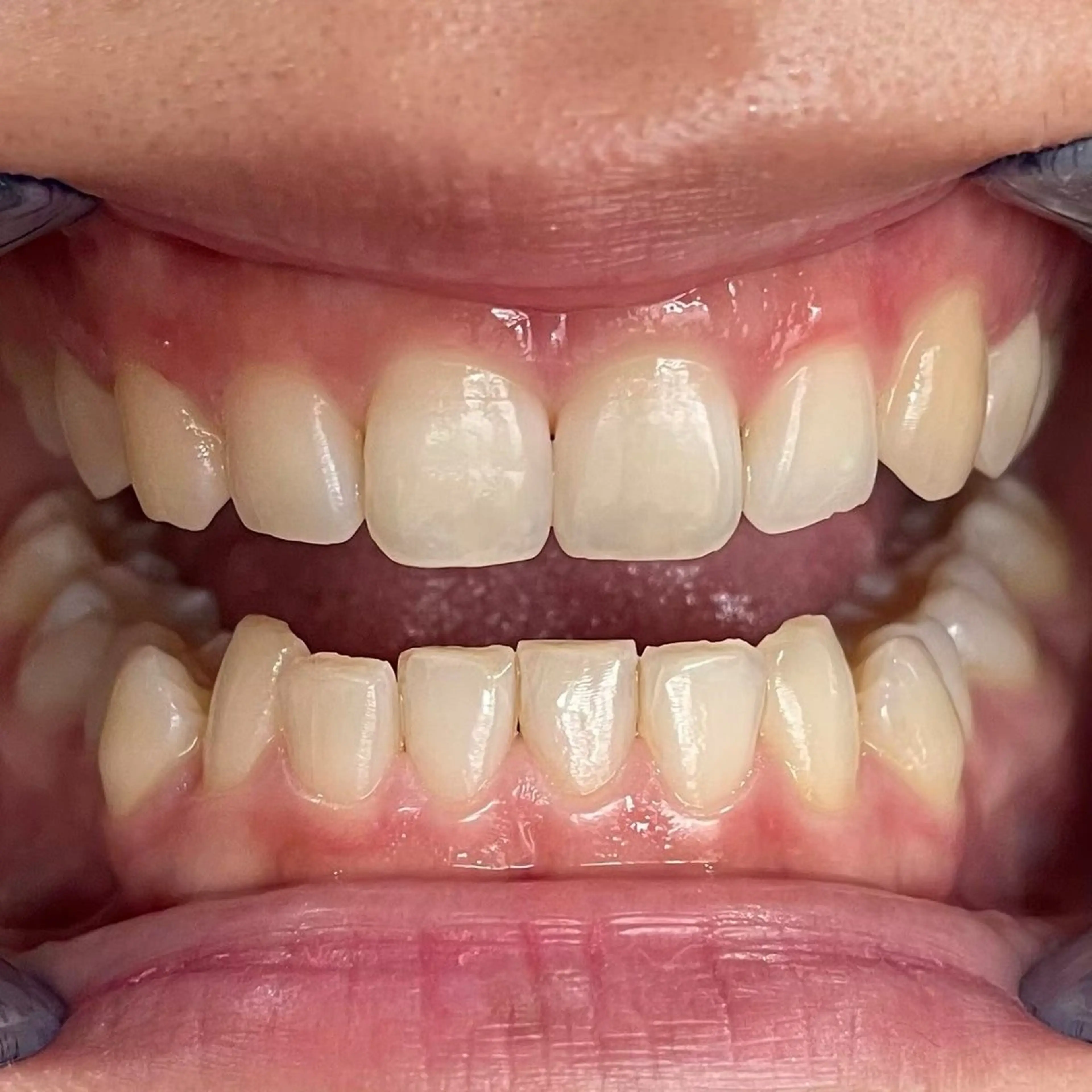 サクッとホワイト所属・セルフホワイトニング サクホワ五反田店のその他イメージ