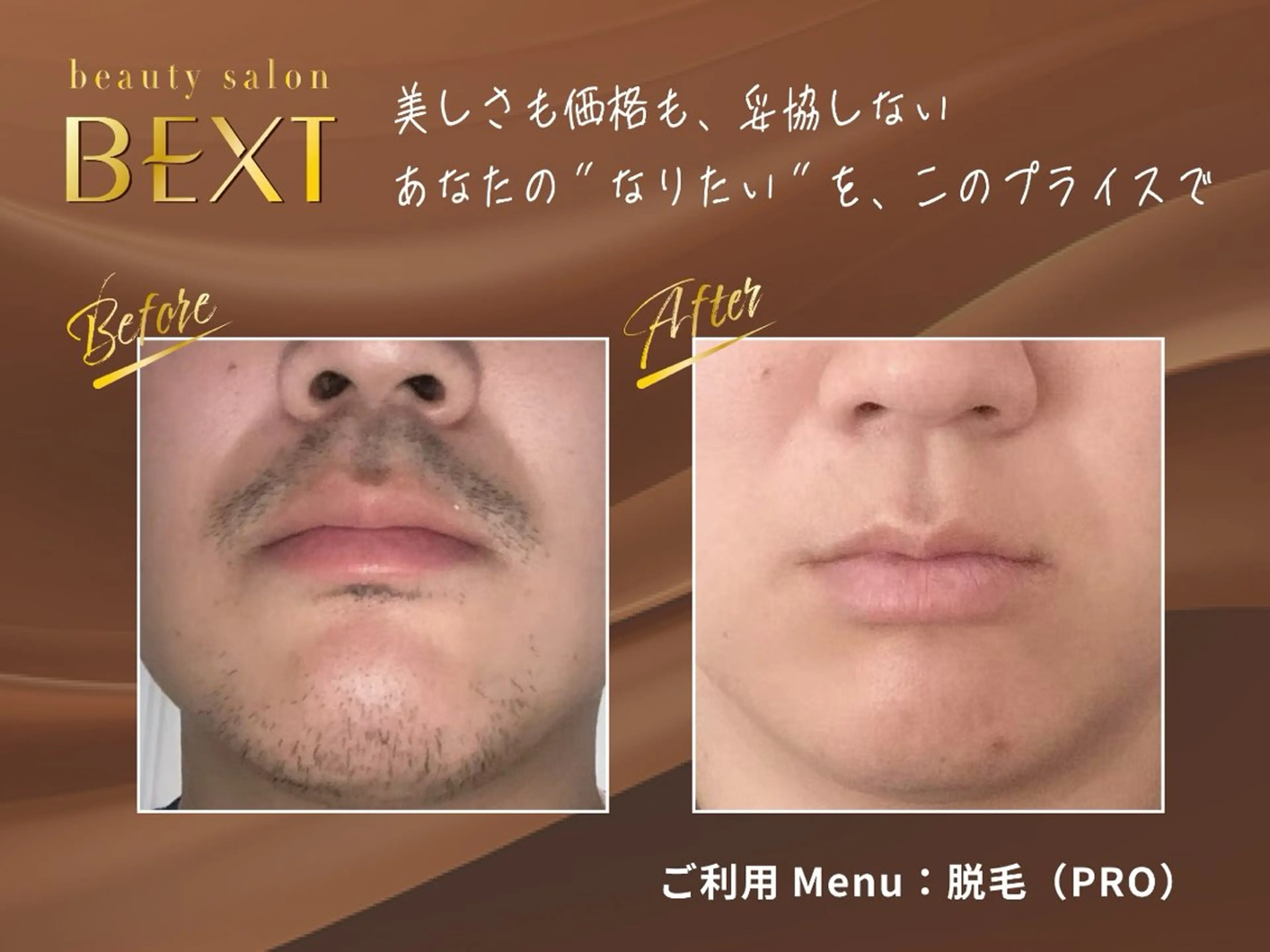 結果重視｜レディース顔脱毛orメンズヒゲ脱毛｜身だしなみケア&すっぴん印象◎名古屋駅・ささしま近くの写真