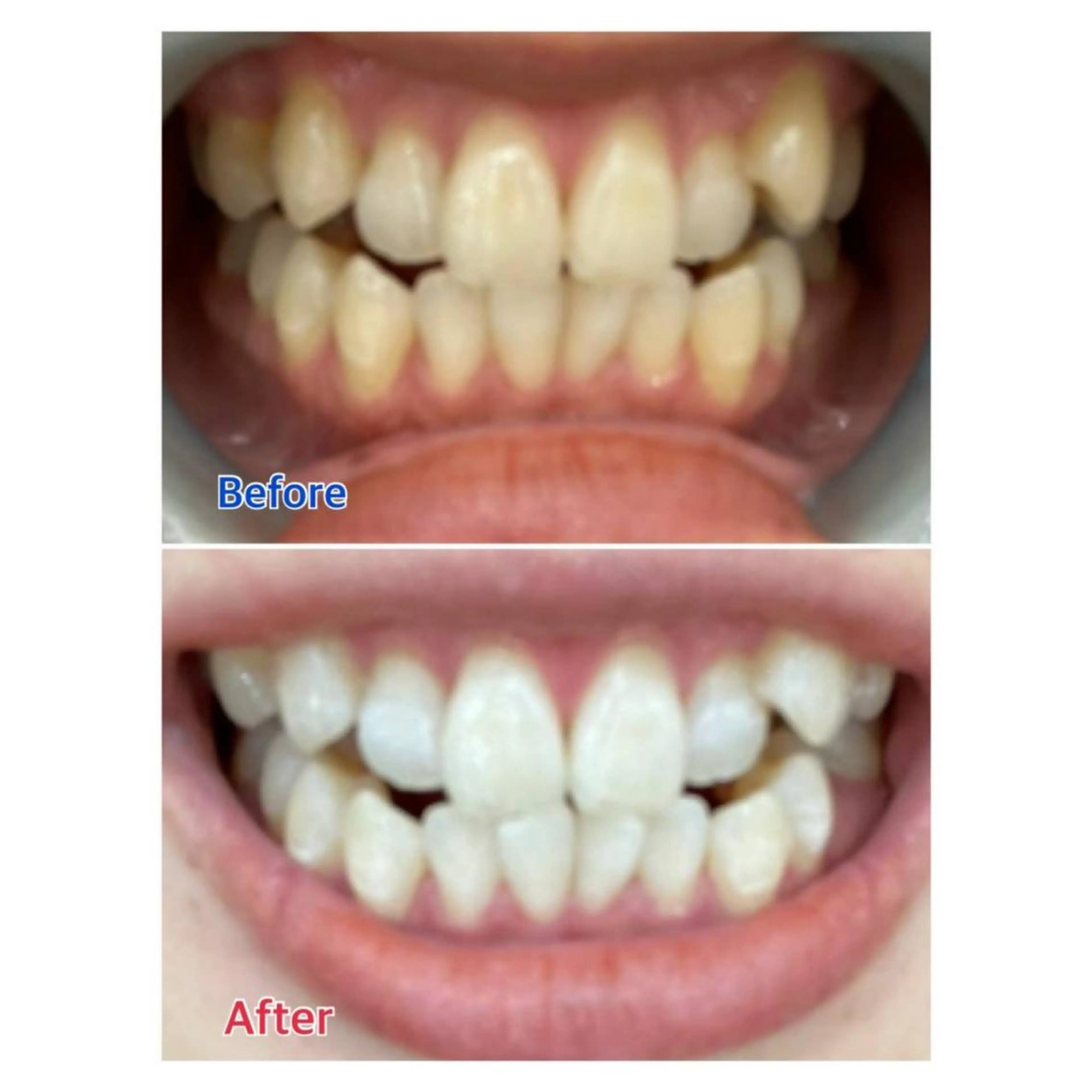 MBEAUTYSALON 千葉店・京成大久保所属・Melty 輝のその他イメージ