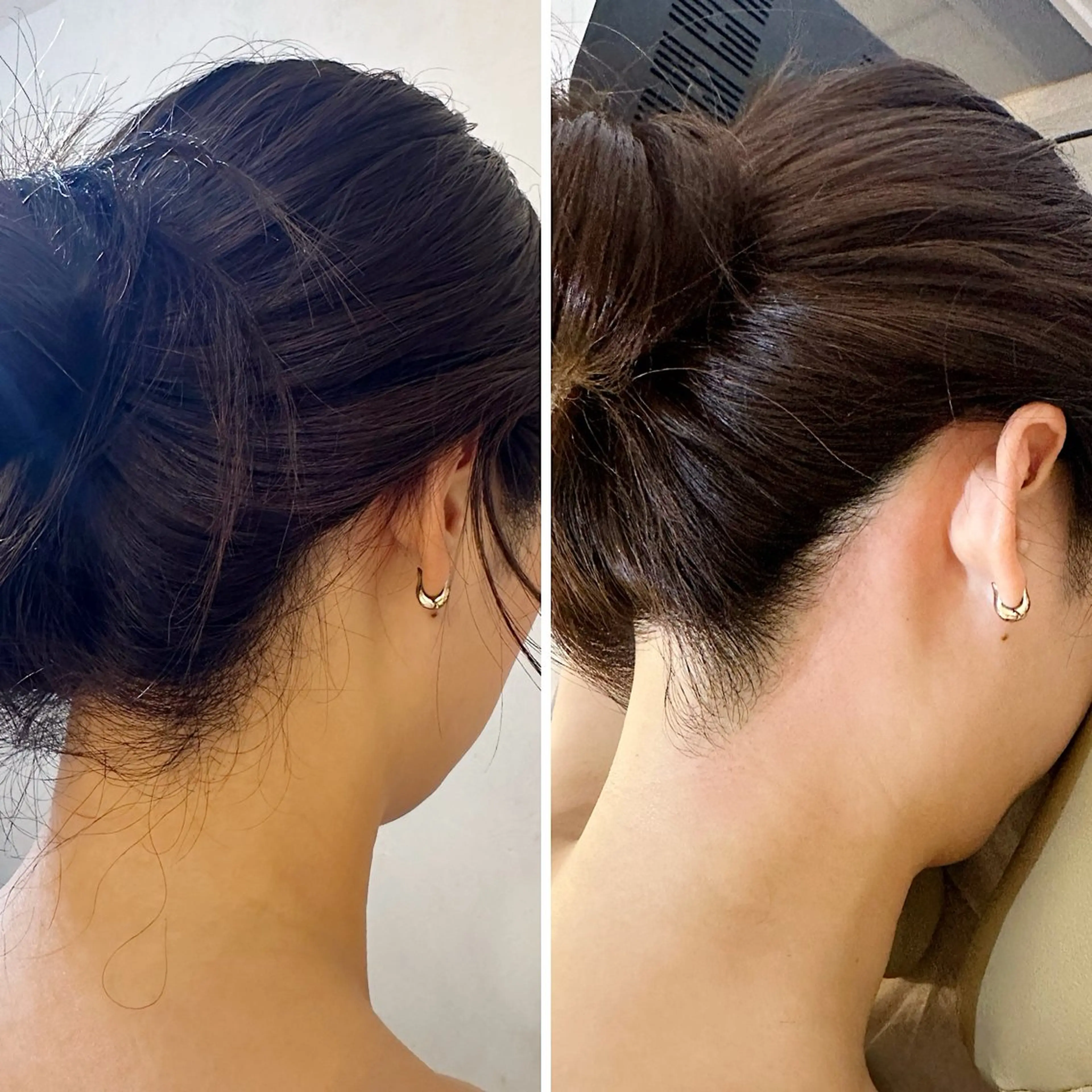 脱毛 うなじ脱毛/美肌脱毛 LABELのエステ・リラクイメージ