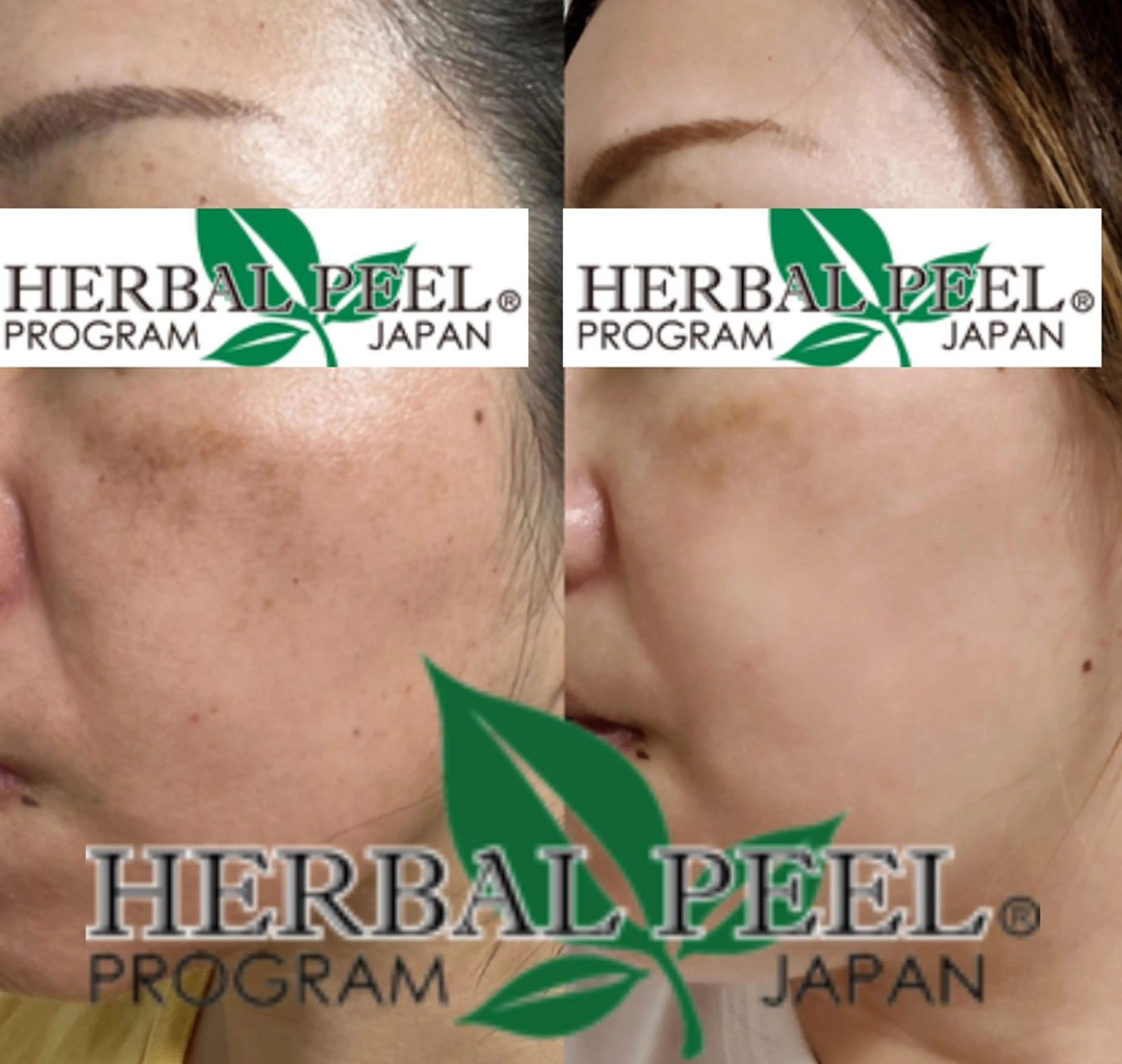 For  Seeds所属・For Seedsのエステ・リラクイメージ