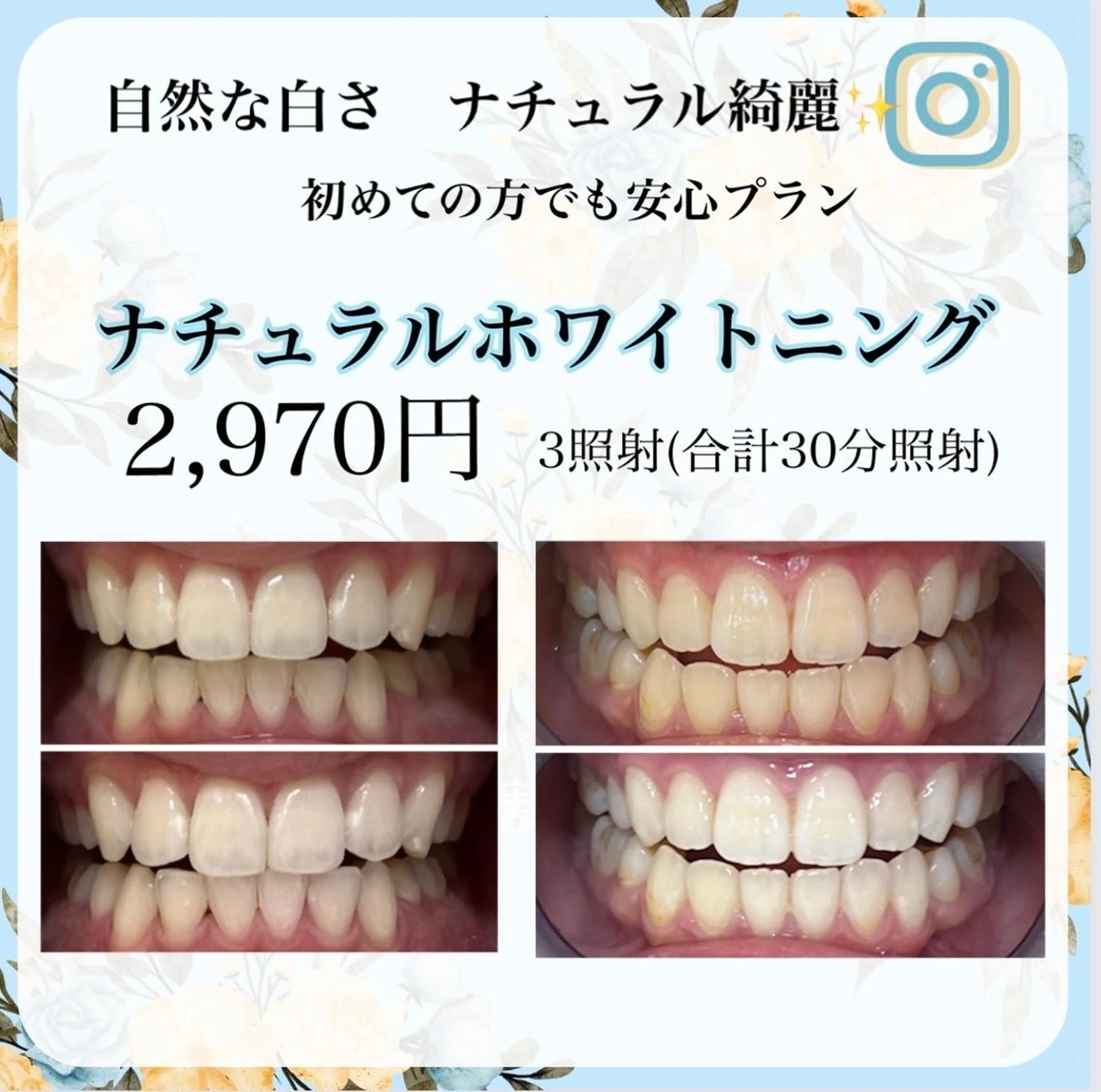 その他 ライトビューティー渋谷本店所属・ライトビューティー 渋谷本店のその他イメージ