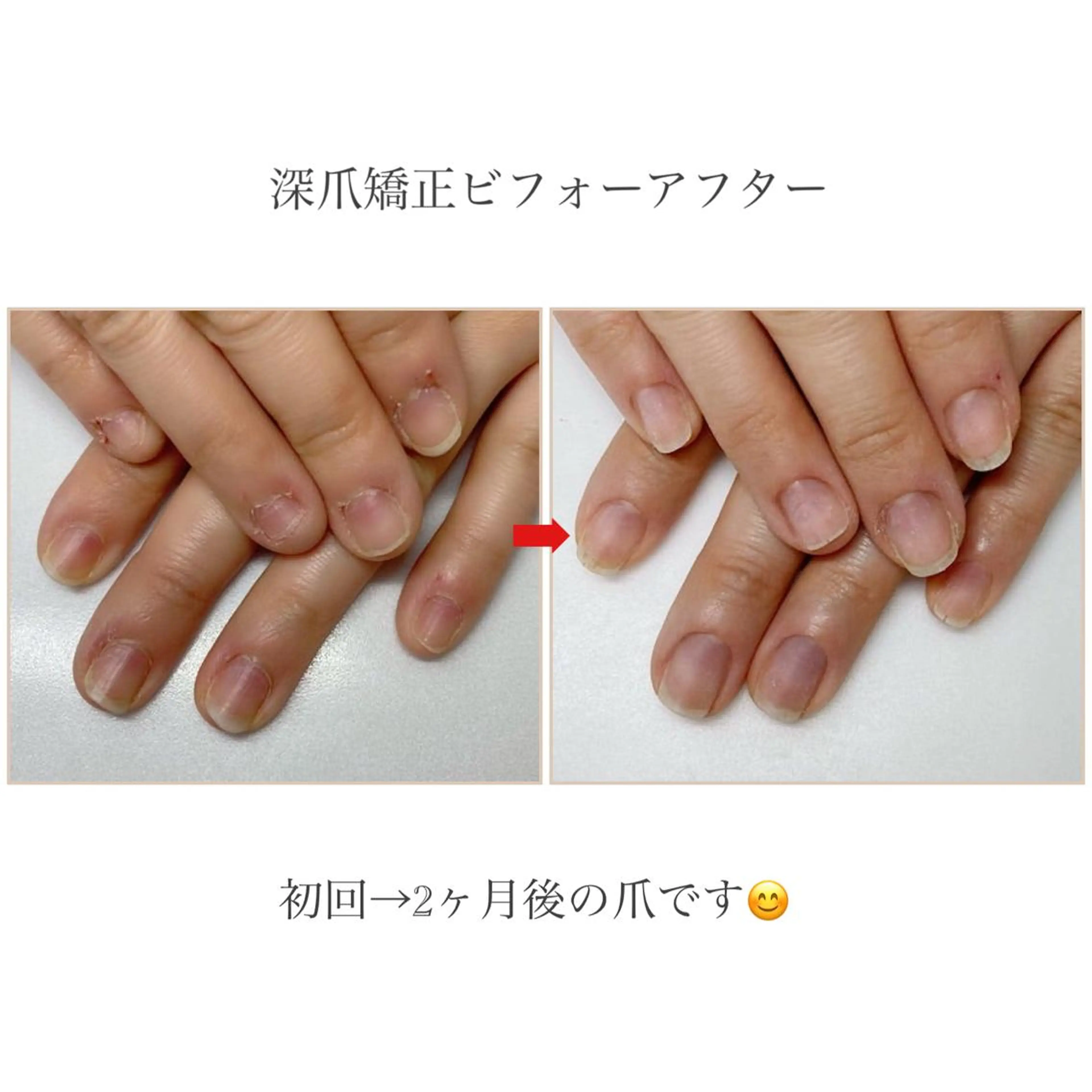 ネイル ネイルサロンアリューム所属・ネイルサロン アリュームのネイルデザイン