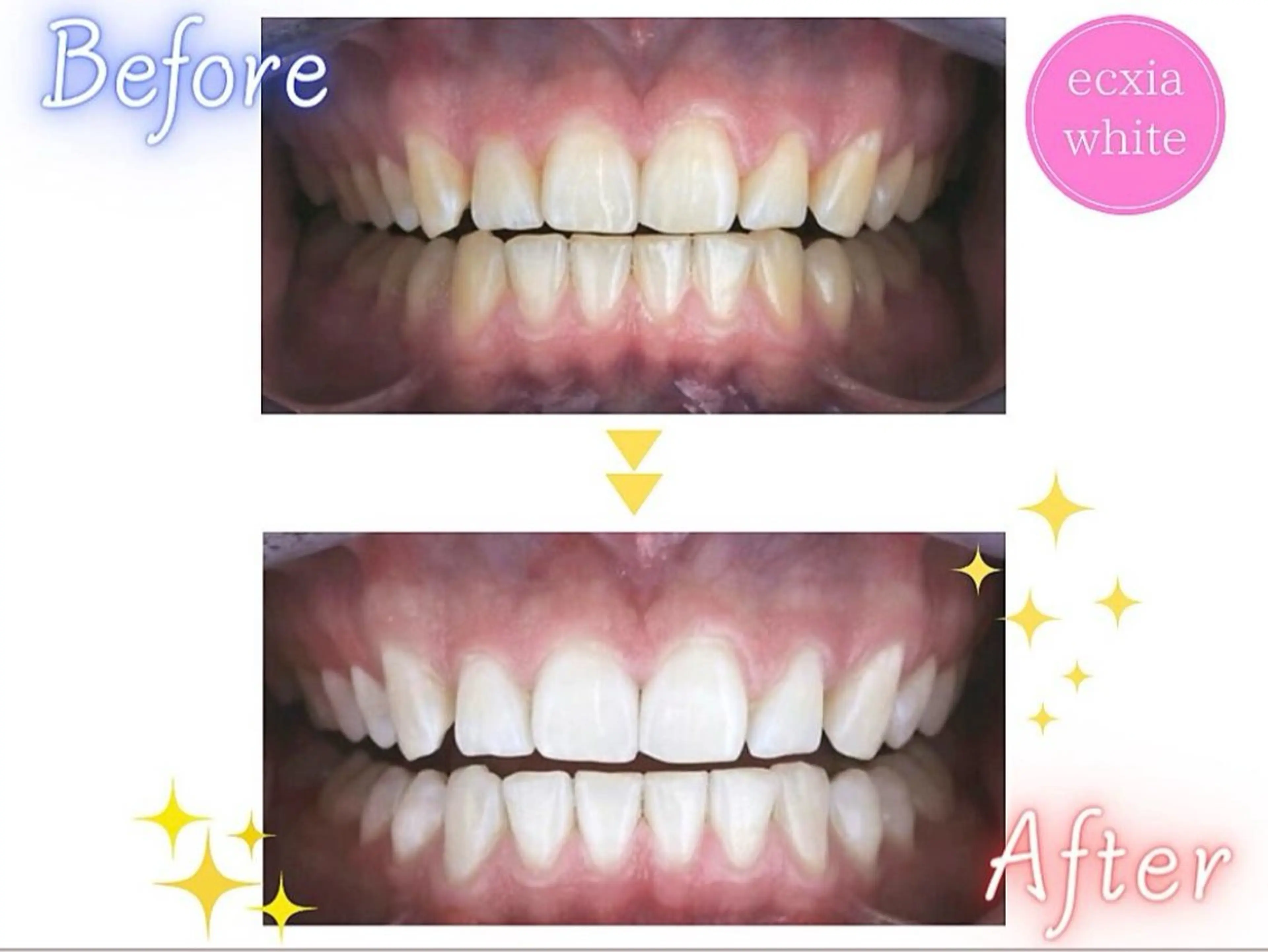 セルフホワイトニング エクシア武蔵小杉店のその他イメージ