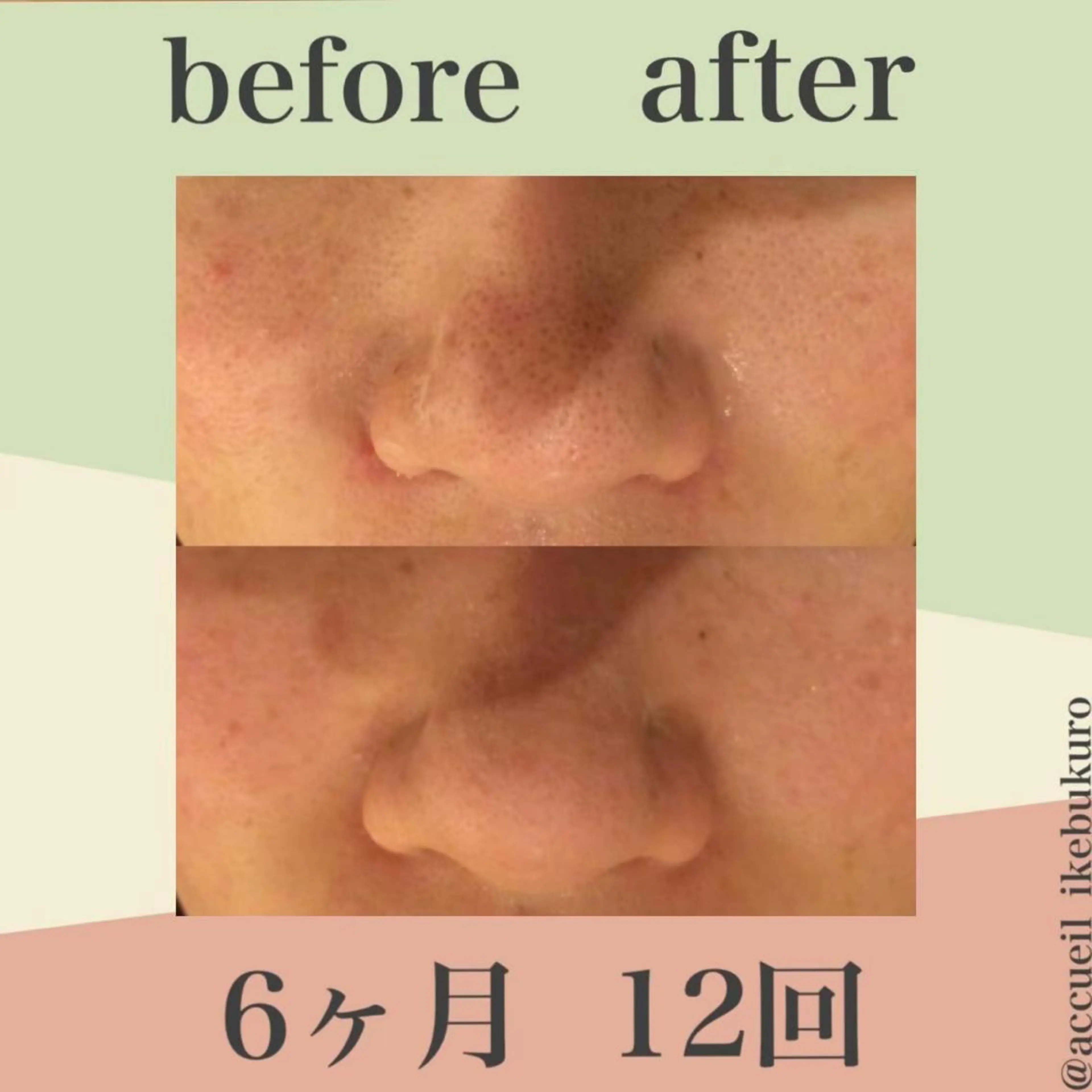 ミディアム カラー パーマ ヘアアレンジ メンズ キッズ ネイル マツエク・マツパ エステ リラク ニキビ・肌質改善専門 ♡人生が変わるサロンのエステ・リラクイメージ