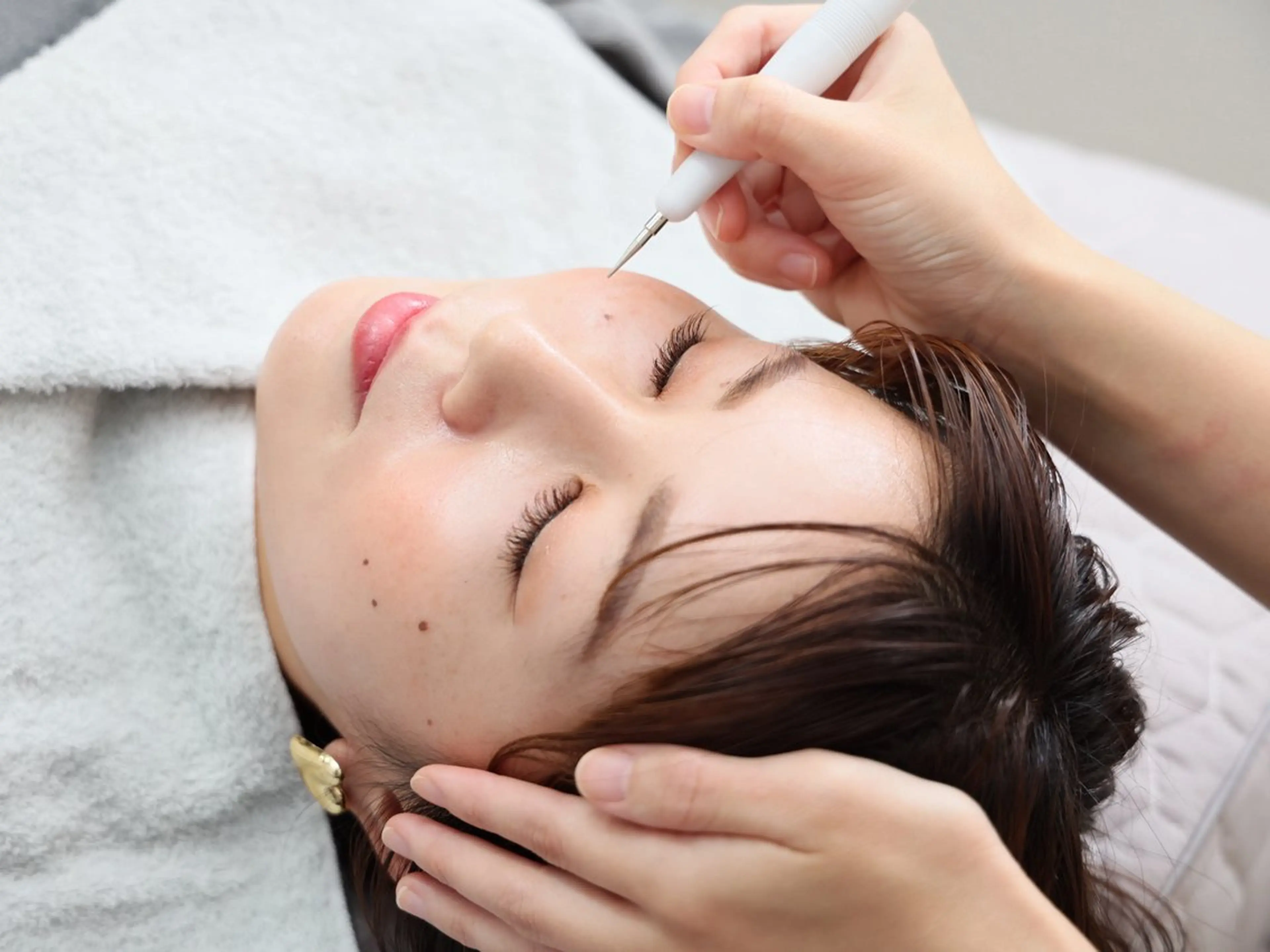 美容鍼脱毛salon リノン吹田駅前店のエステ・リラクイメージ