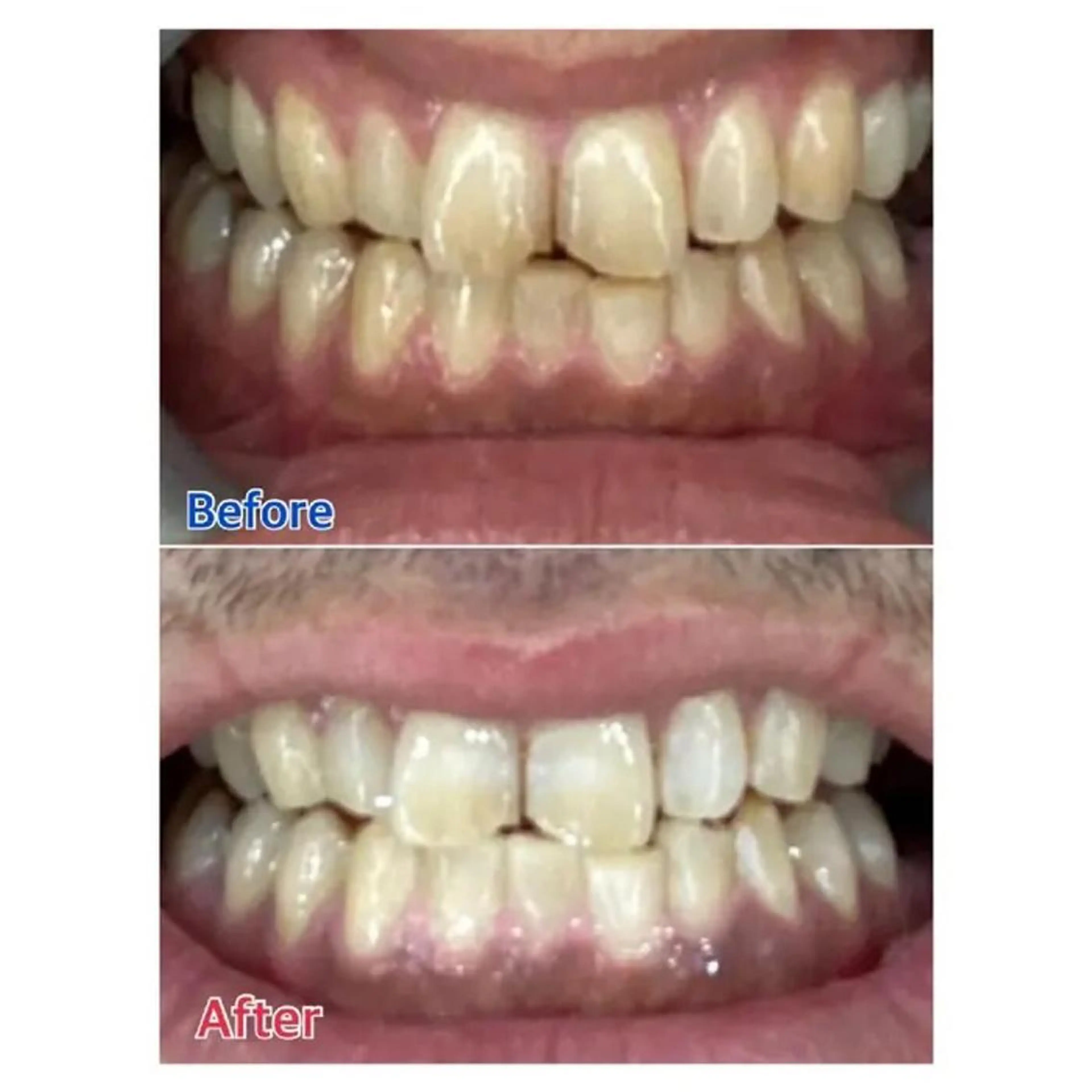 M渋谷店所属・Ｍ渋谷 ホワイトニングのエステ・リラクイメージ