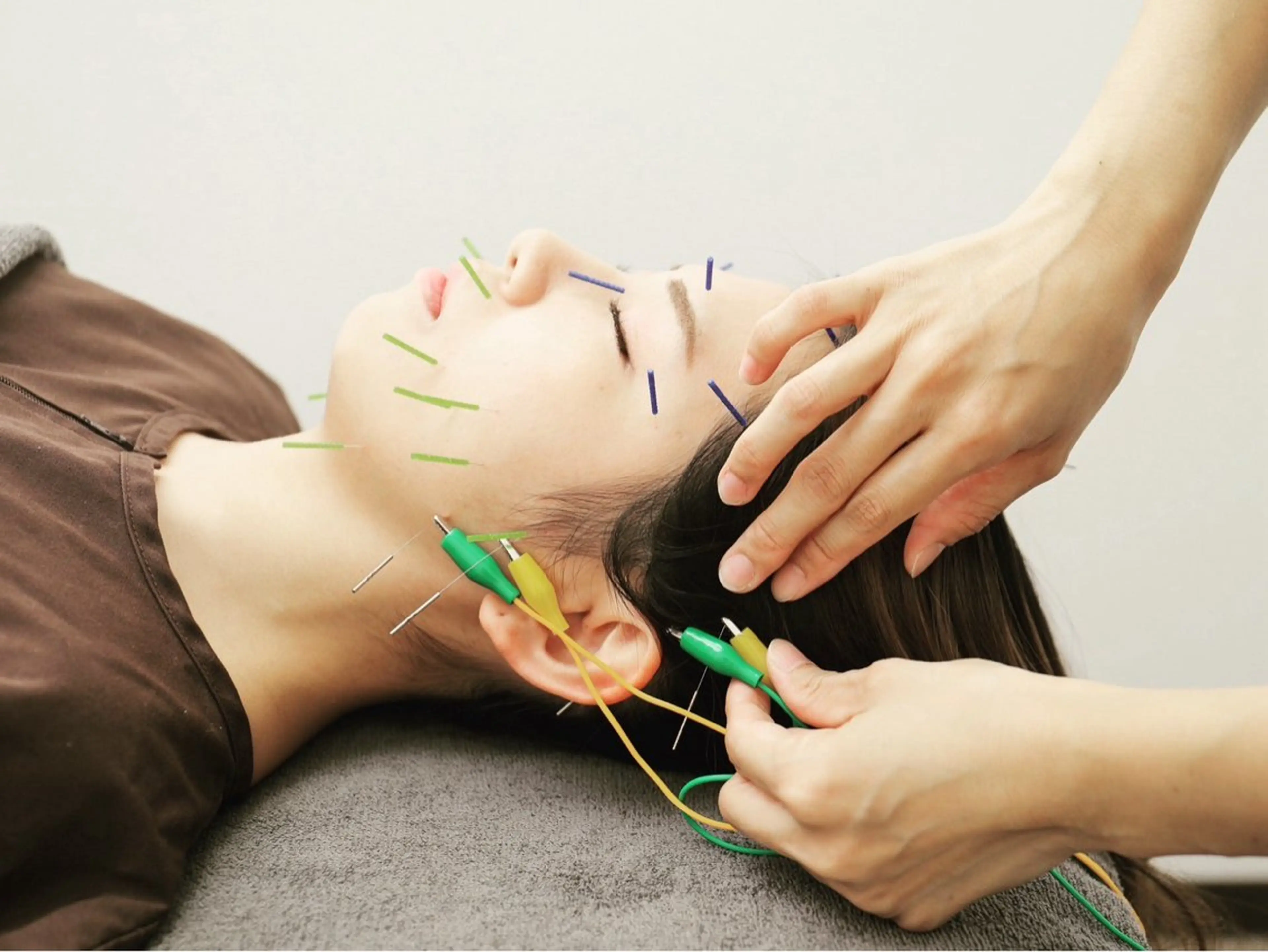 hari salon de off　美容鍼灸×小顔整体【ハリサロンドオフ】所属・美容鍼灸×小顔整体♡ ハリサロンドオフ堺東のエステ・リラクイメージ