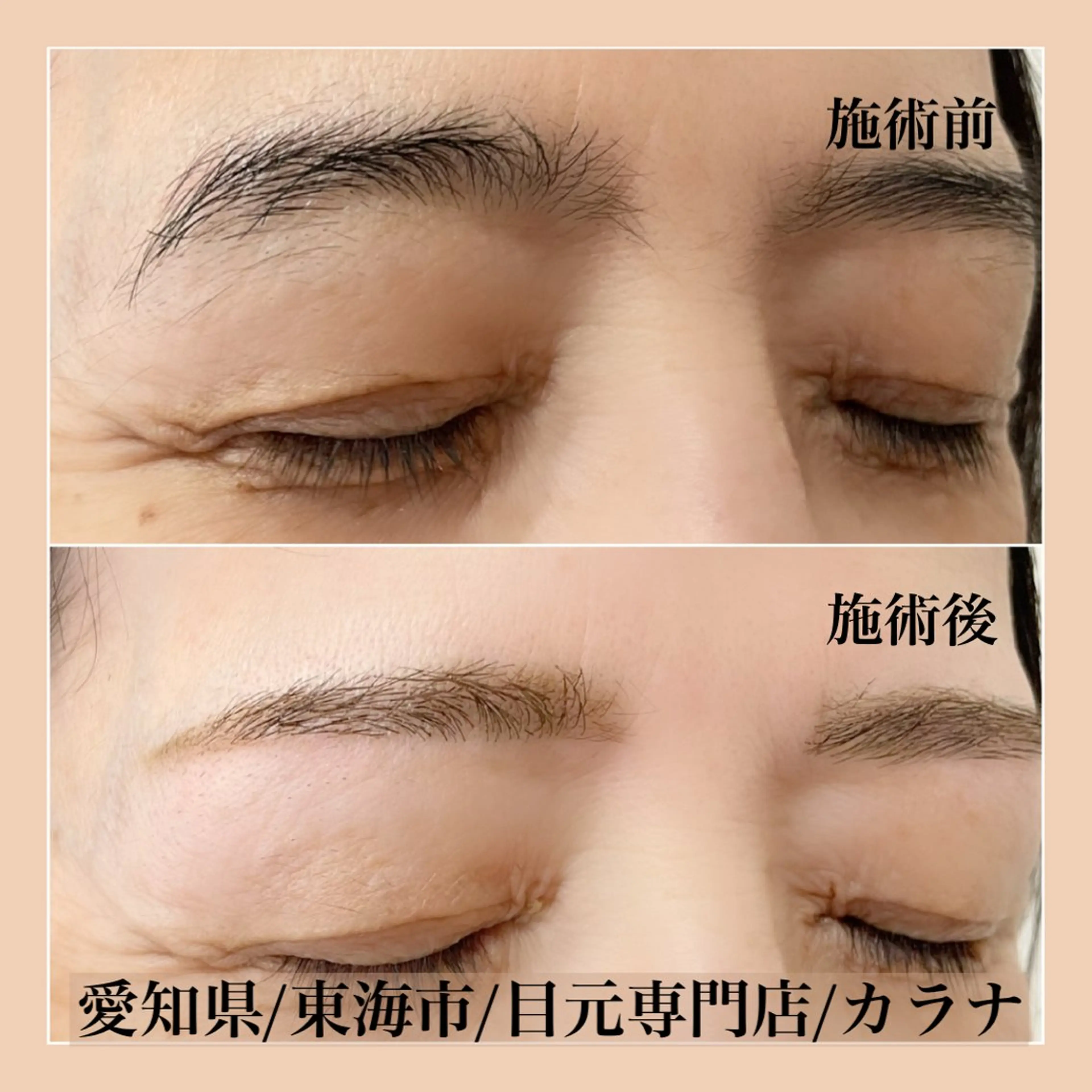 アイブロウ 眉毛ワックス脱毛 ワックス脱毛 その他(アイブロウ) Callana所属・Callana KAYOのエステ・リラクイメージ