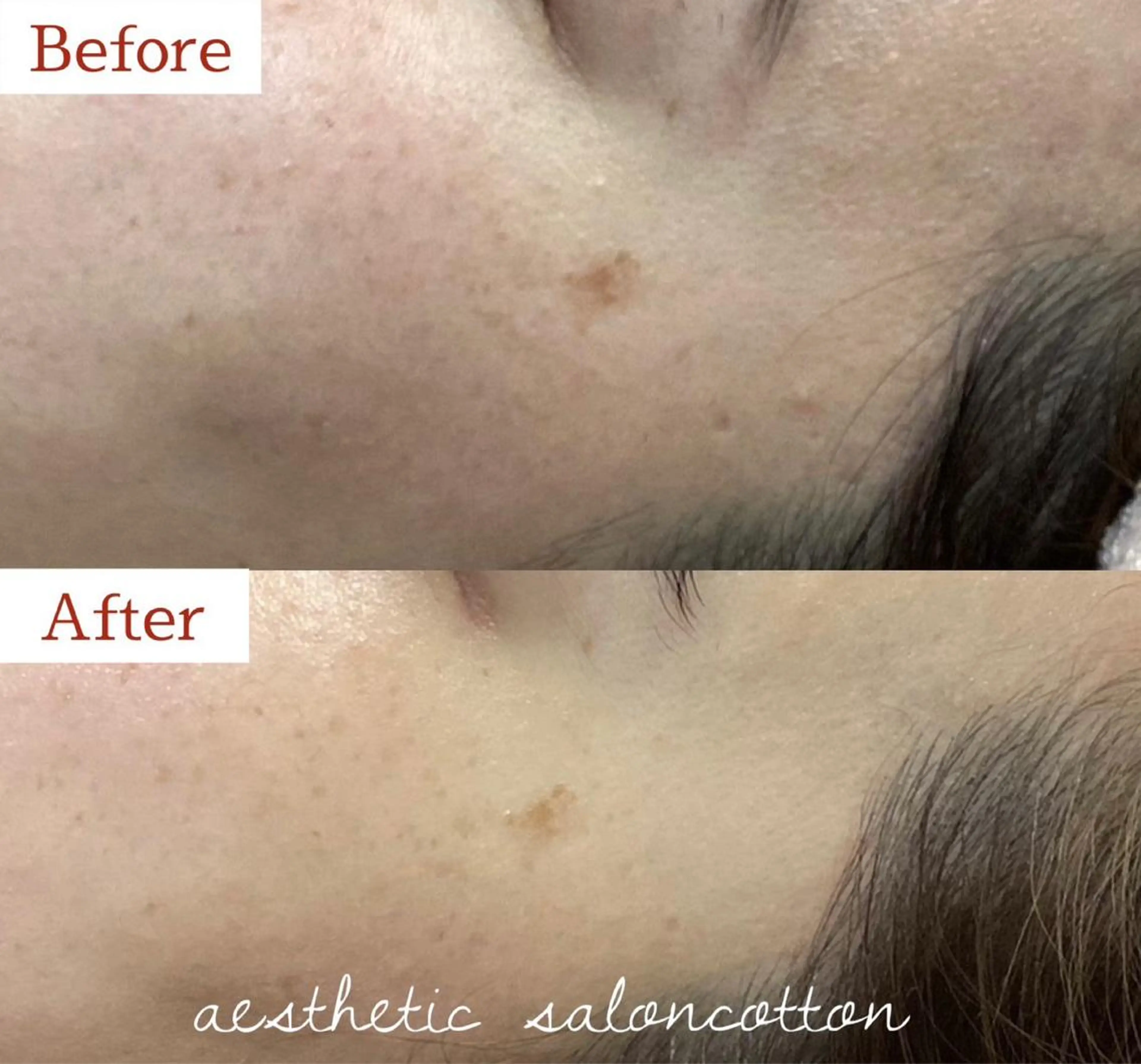 都度払い 肌質改善専門サロンのエステ・リラクイメージ