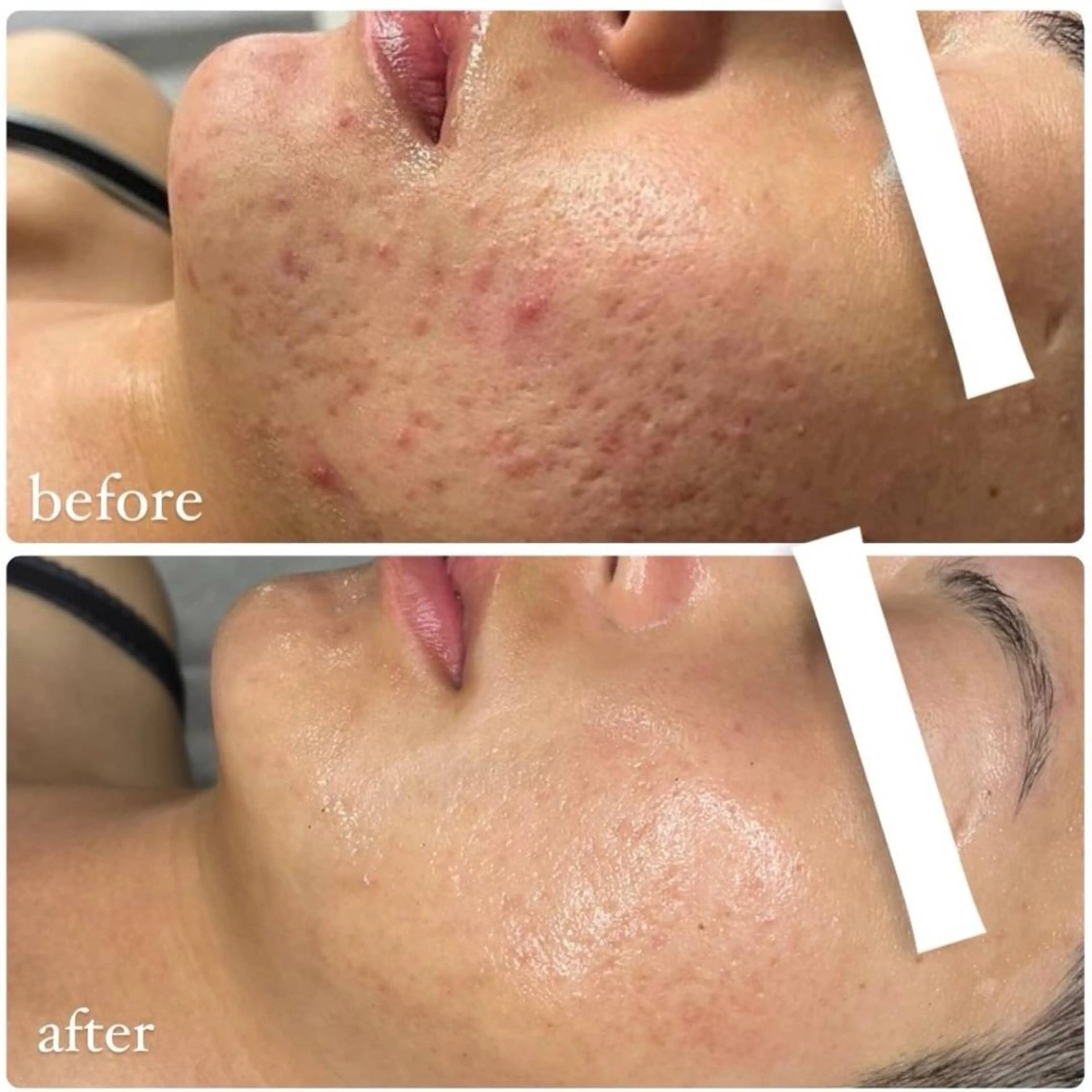 eyebrow design Arce.所属・山本 克輝の眉毛・アイブロウイメージ