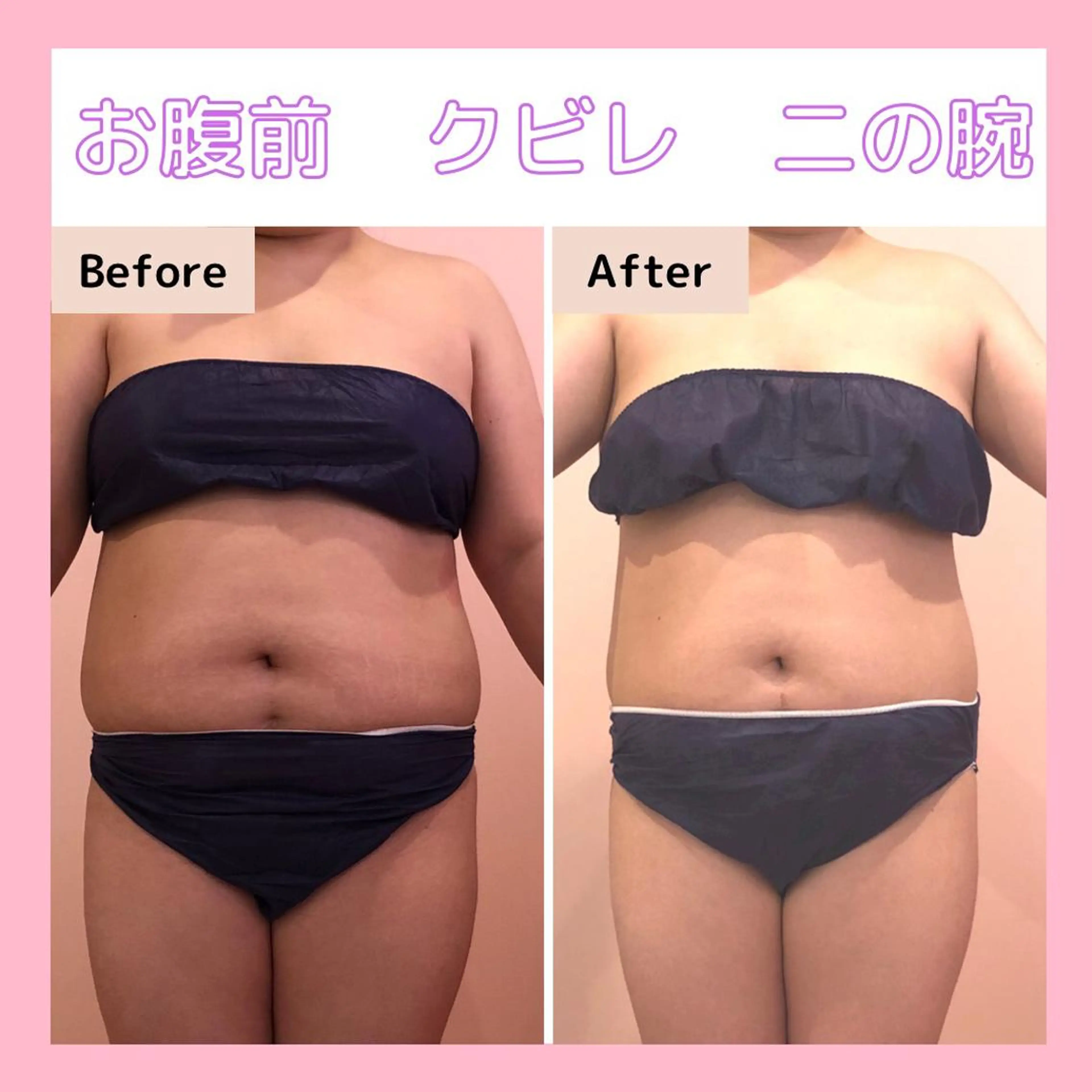 エステサロン　Sブランペタル所属・三沢市エステサロン Sブランペタルのエステ・リラクイメージ