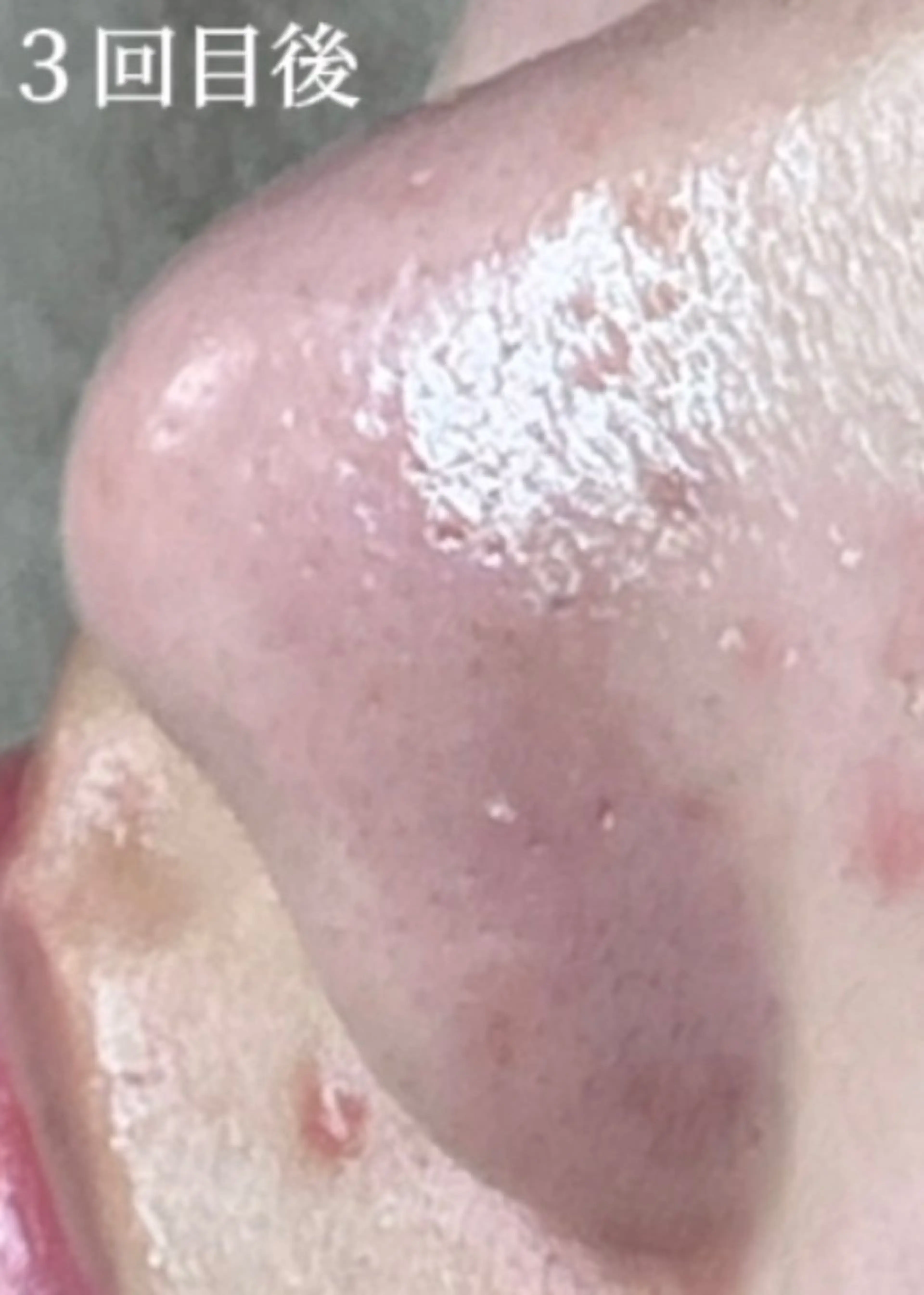 毛穴肌質ケアサロン Yourmeユアミーのエステ・リラクイメージ