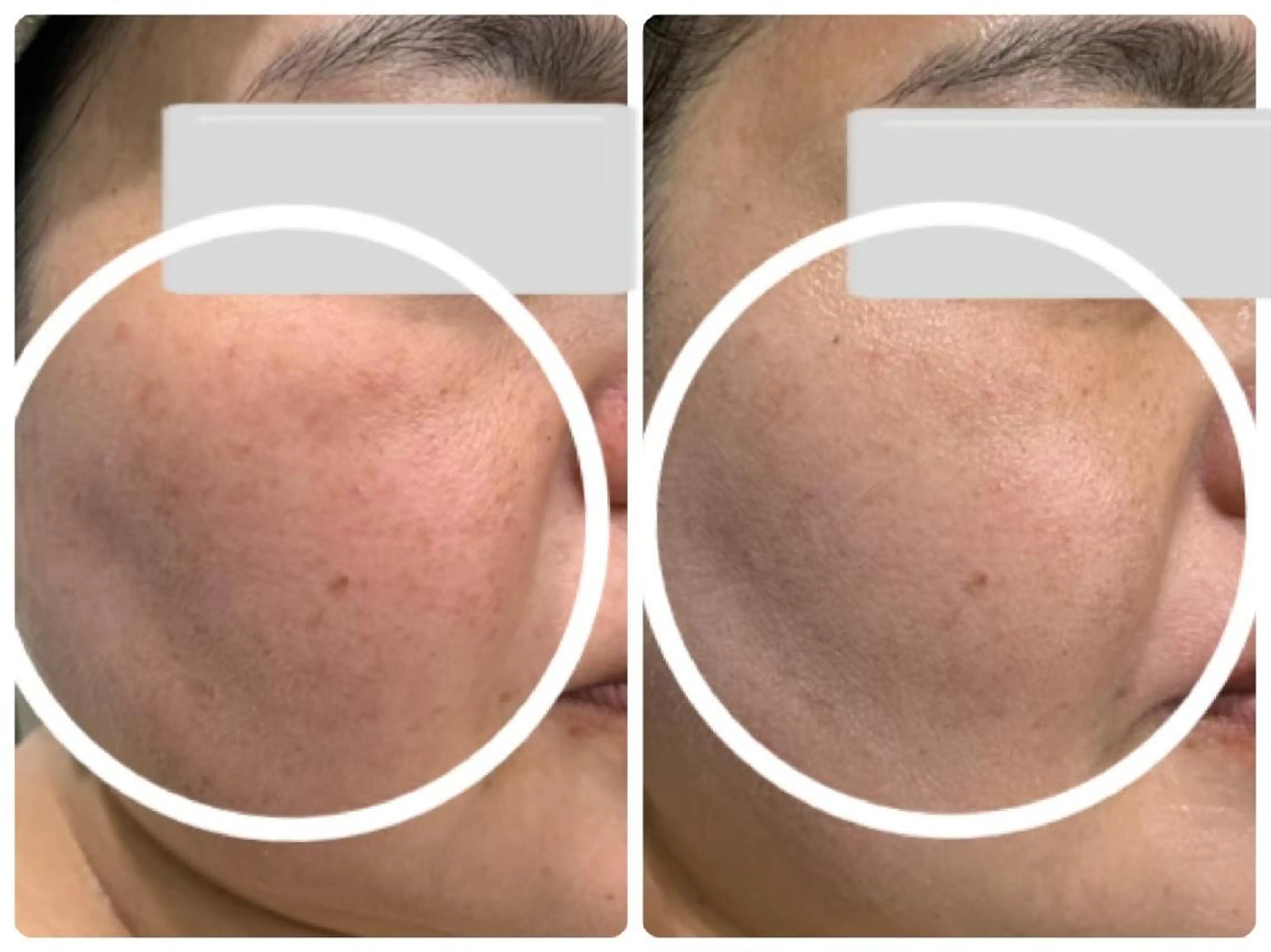 PIP🌹 さえのマツエク・マツパデザイン