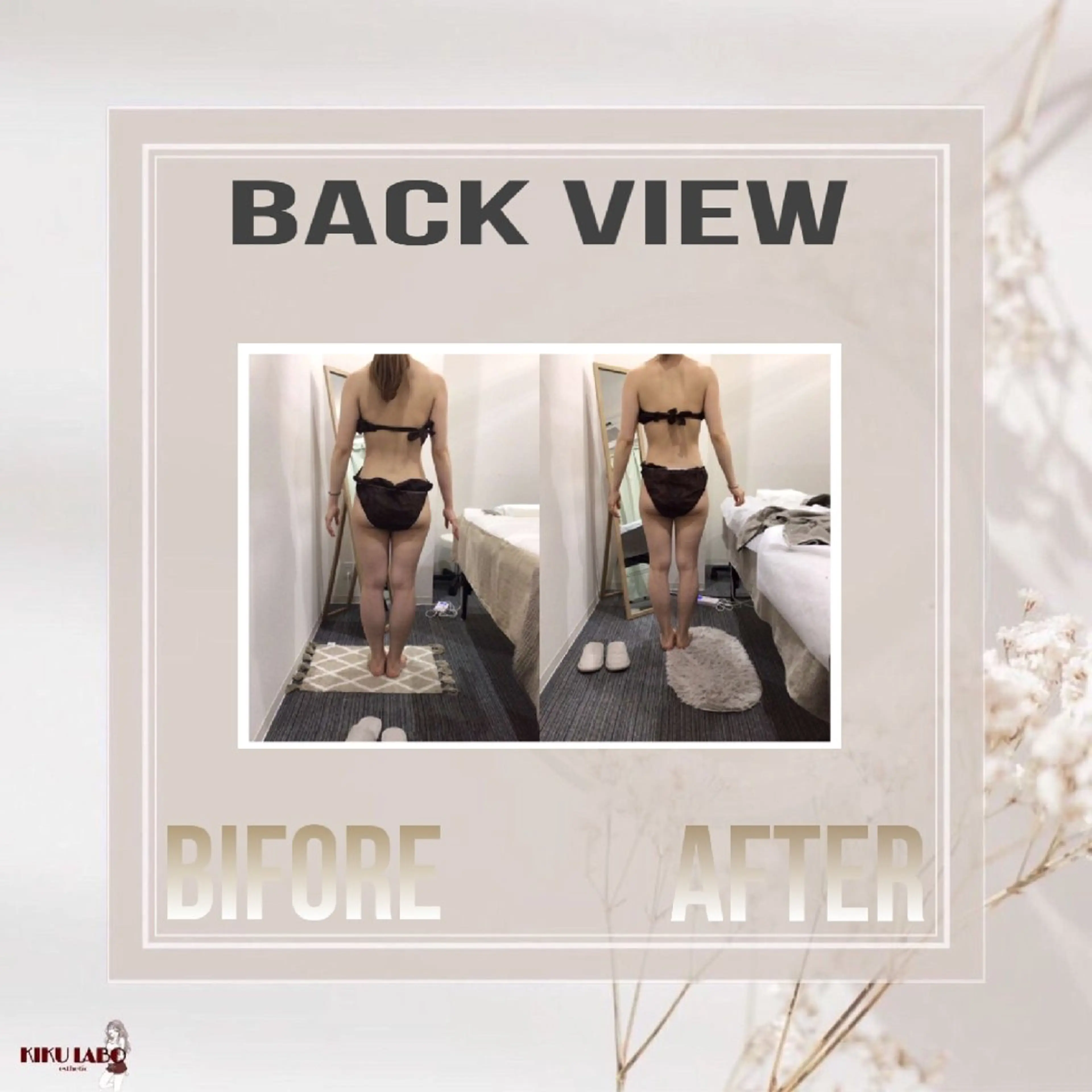 【2〜4回目までのミニモ限定価格✨️】脚痩せ集中コース◎通常価格16000円→8990円の写真