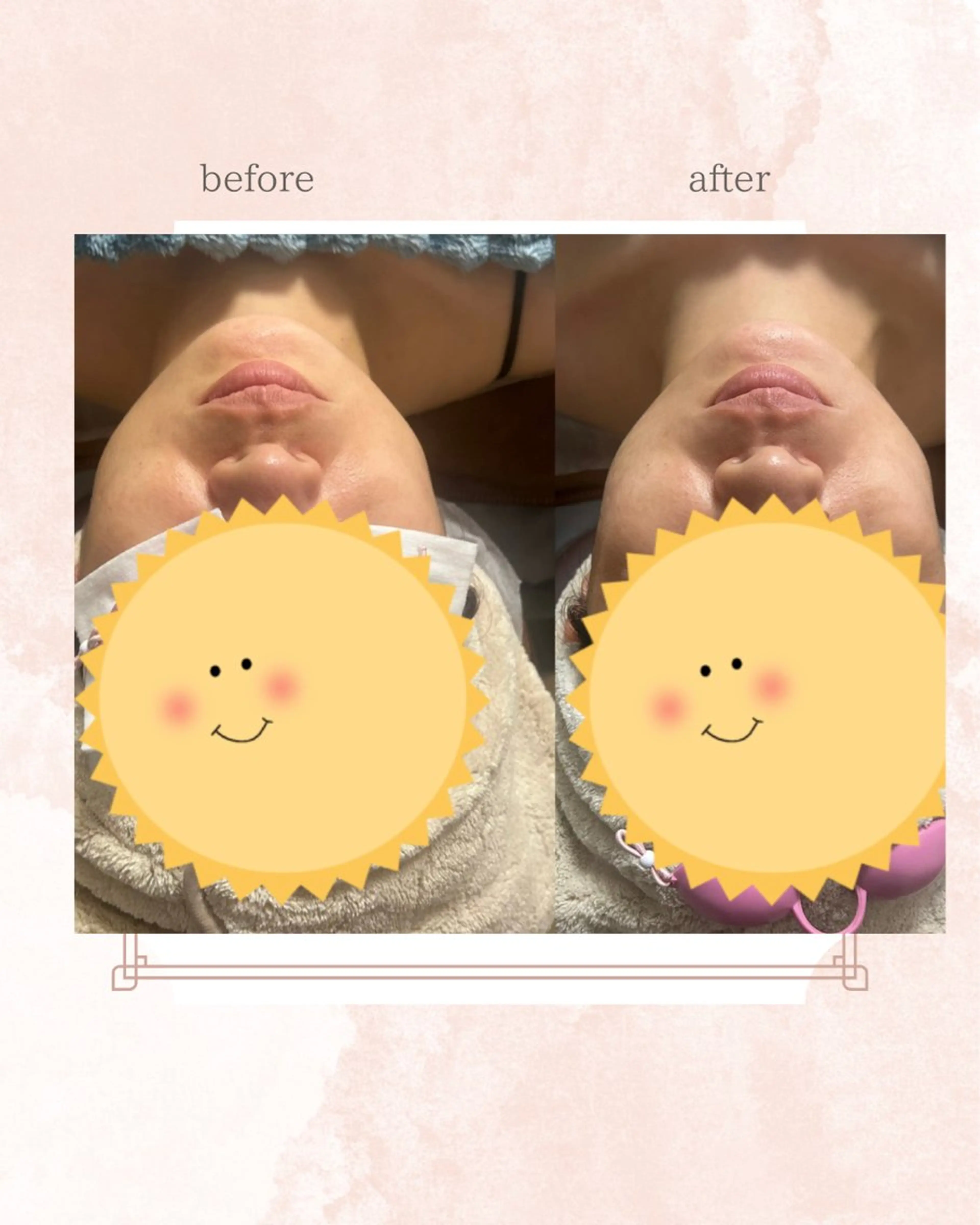 エステ Belle ＋vi（ベル）のその他イメージ