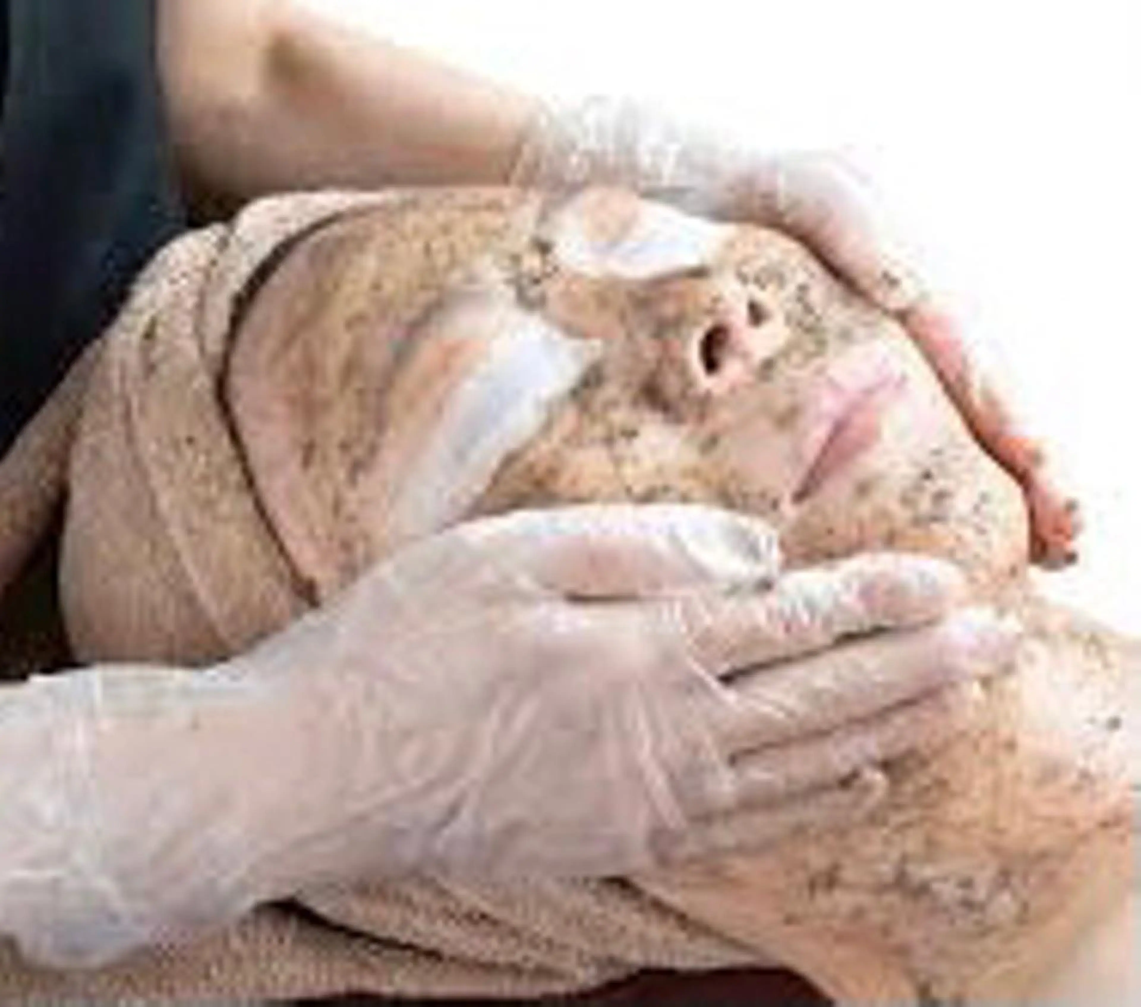 ニキビ毛穴本格肌改善ハーブフェイシャル1,5g/ピーリングの写真