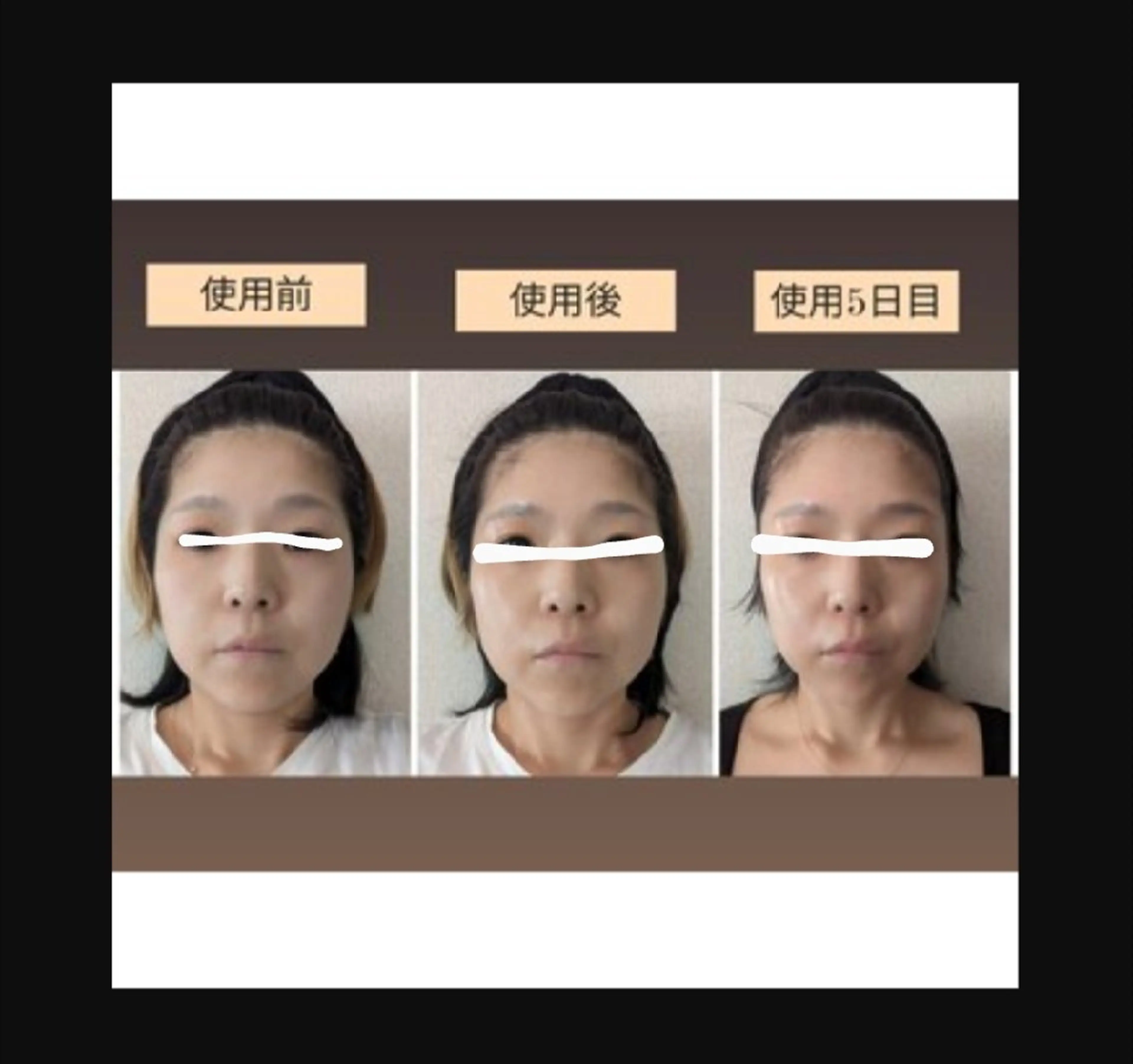 EMS搭載!3in1美顔器使用のトリートメントの写真