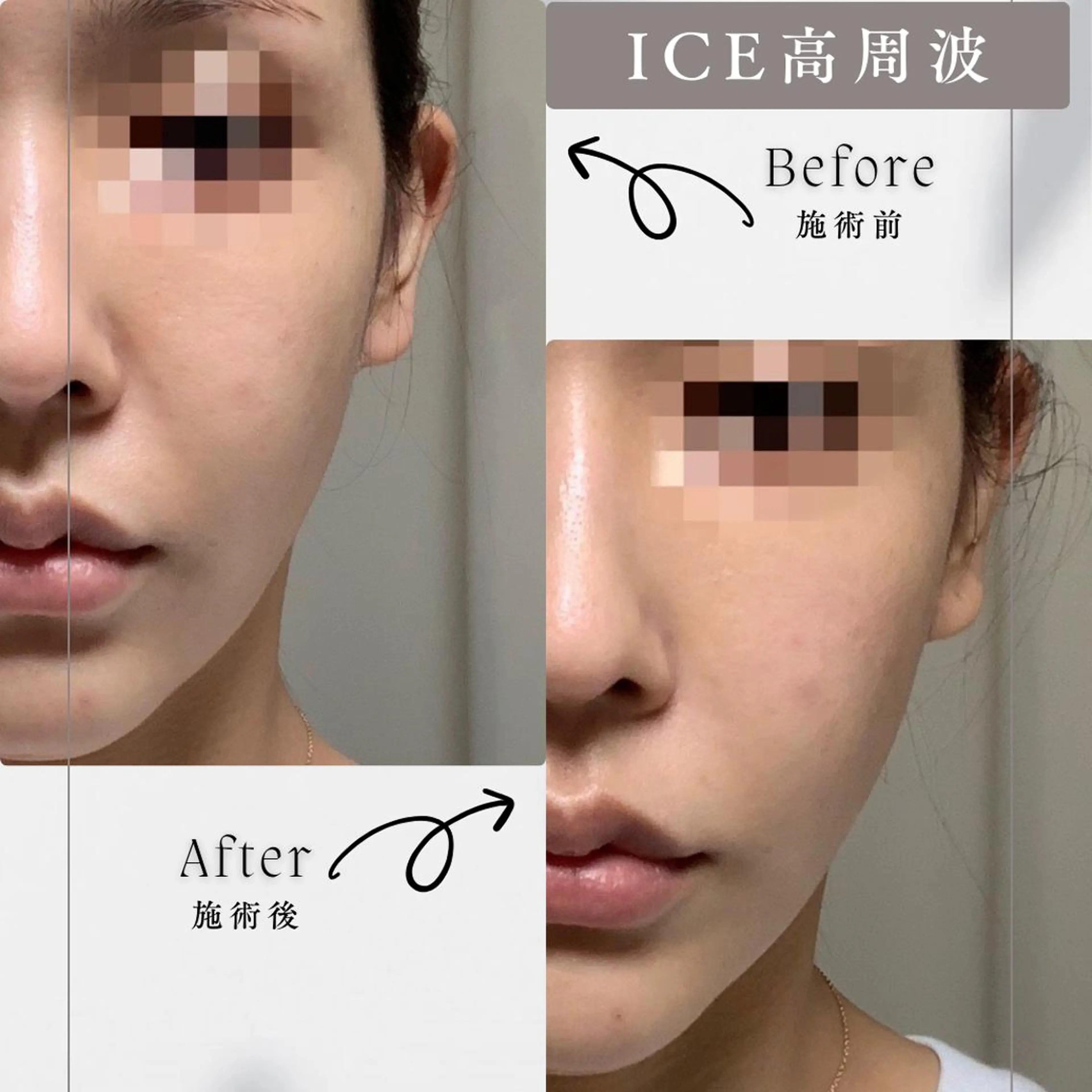 男女同額完全個室脱毛 LEPIA内田のエステ・リラクイメージ