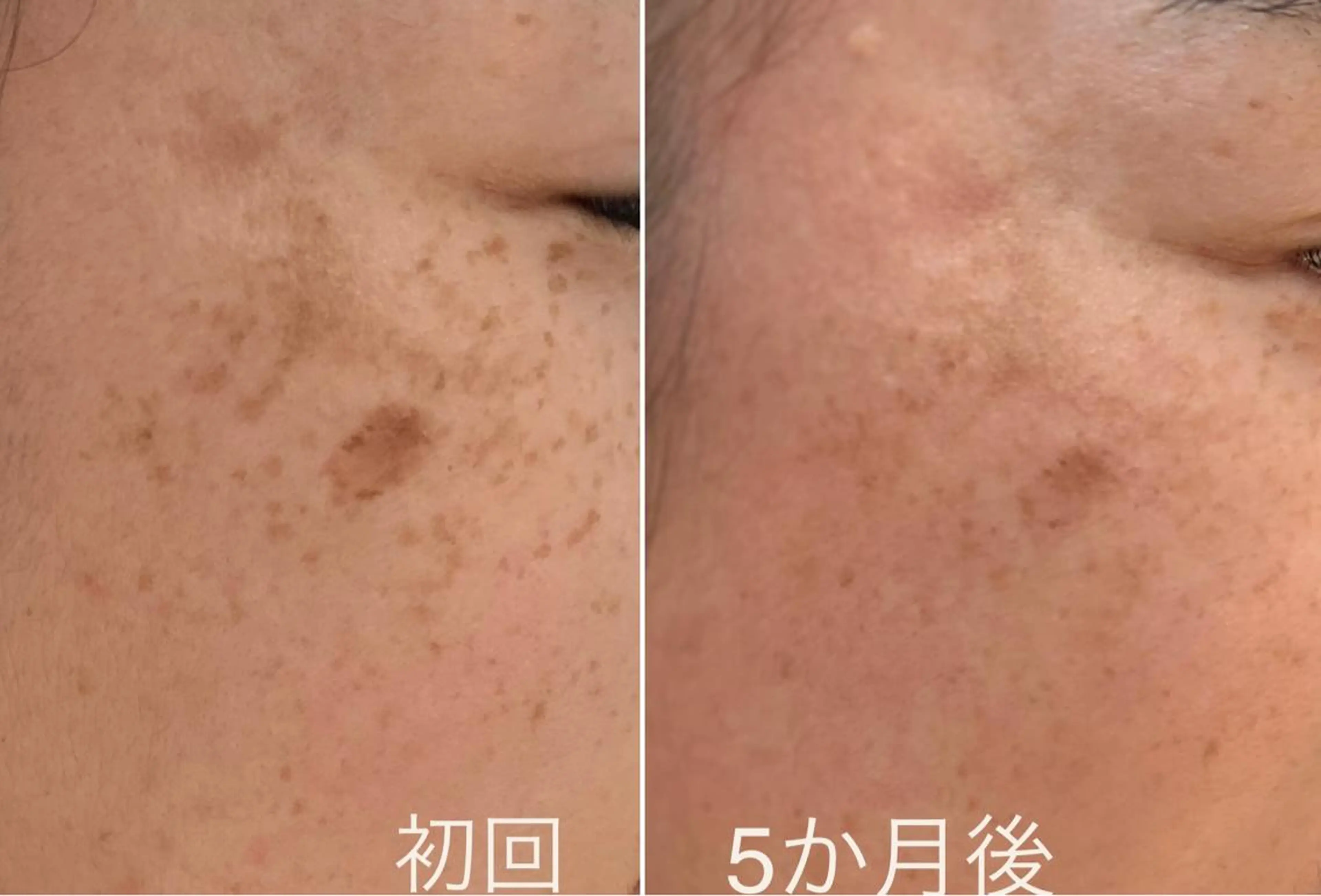 エステ シミケア E Lashのエステ・リラクイメージ