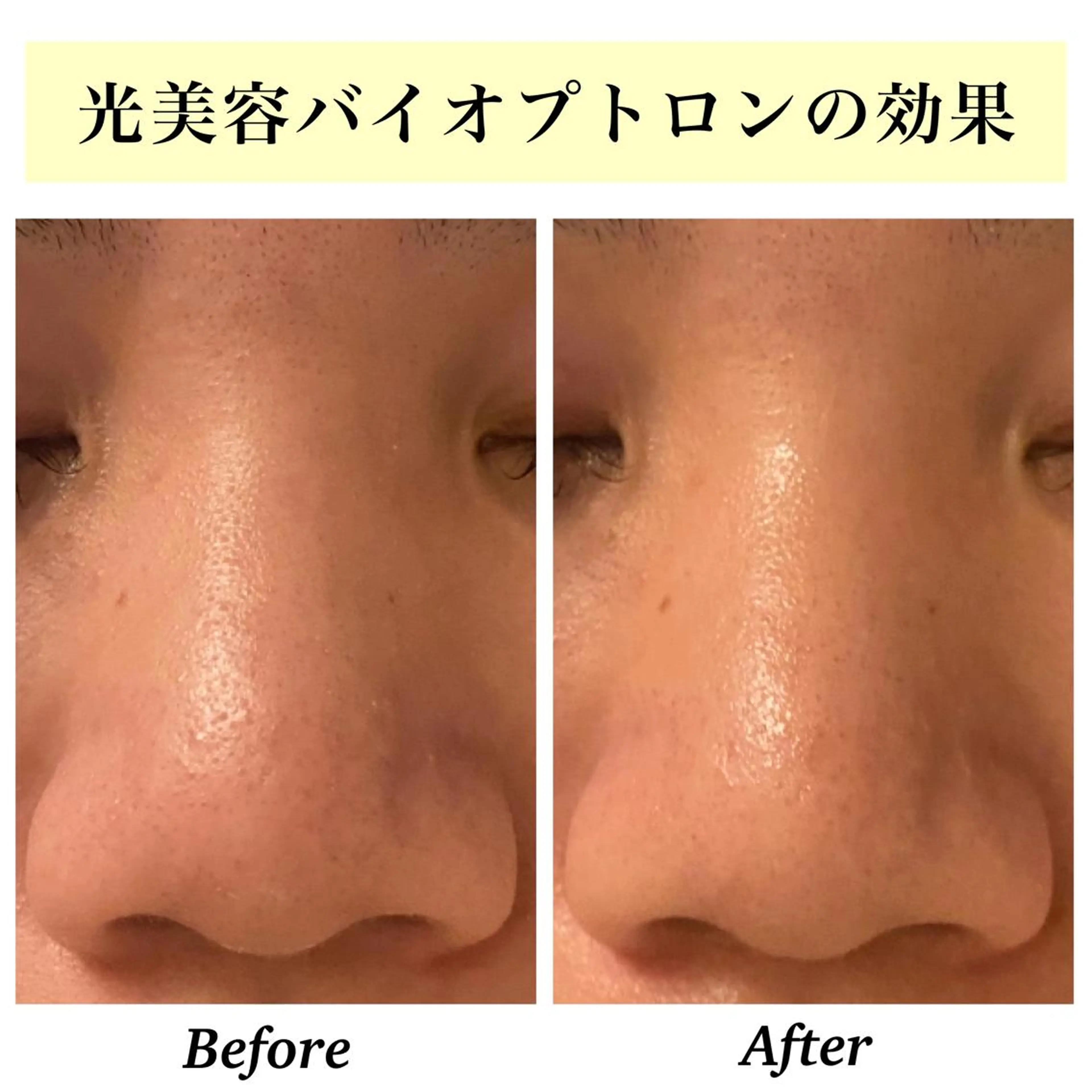 エステ リラク Bellesthe (ベルエステ)のエステ・リラクイメージ