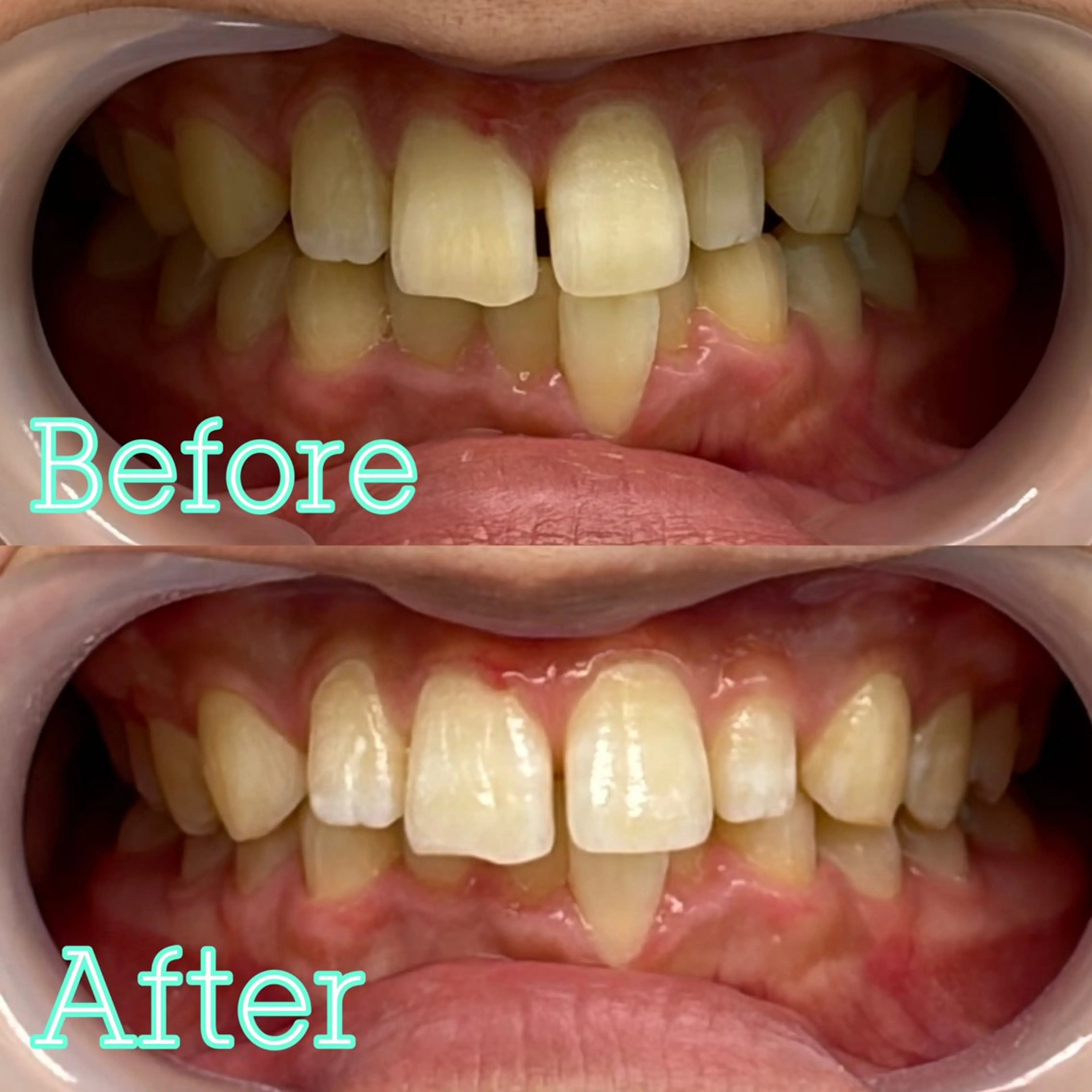 歯のホワイトニング専門店 MIGAQ 京都四条大宮店所属・佐藤 未来の眉毛・アイブロウイメージ