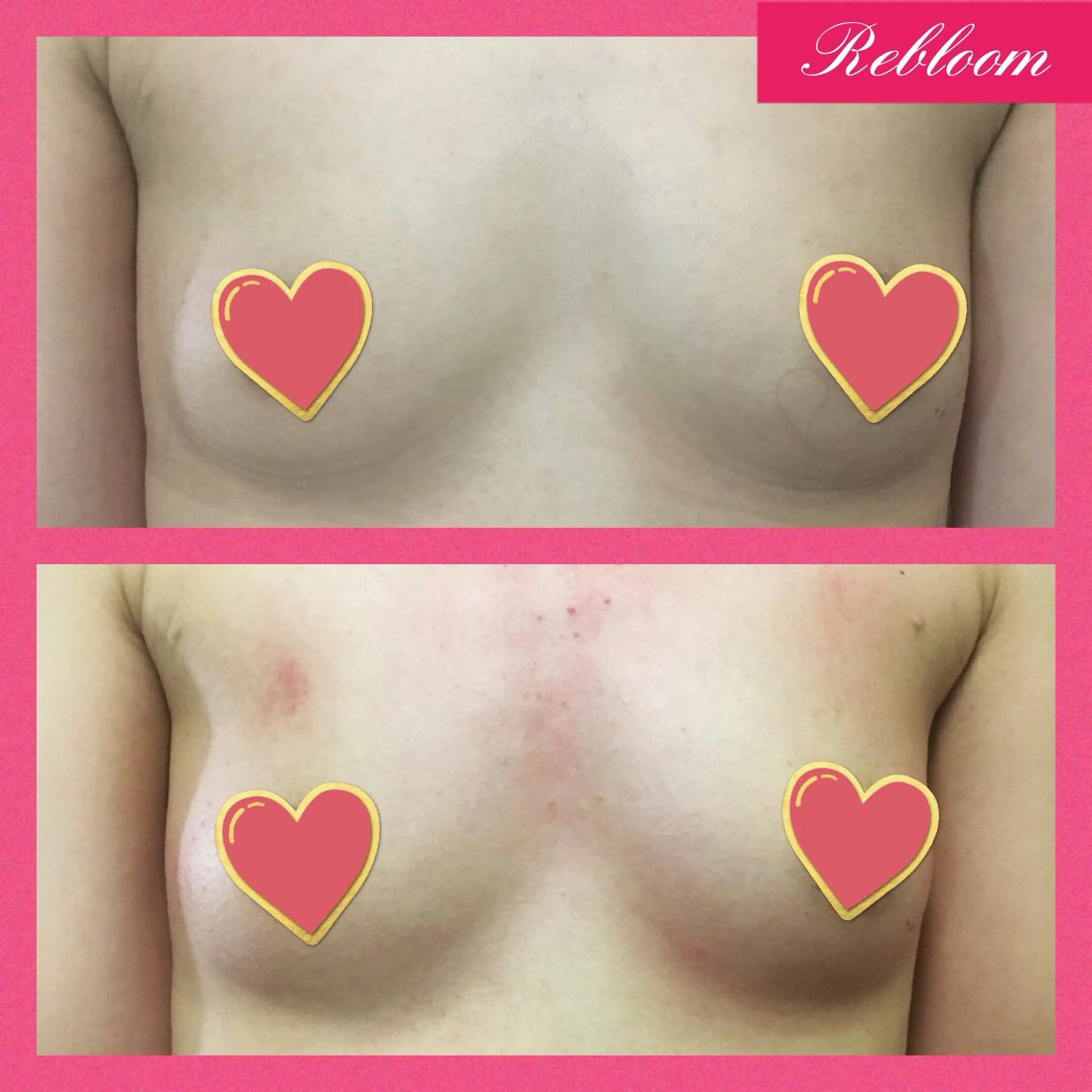 エステ デリケートな悩み解決 Rebloomのエステ・リラクイメージ