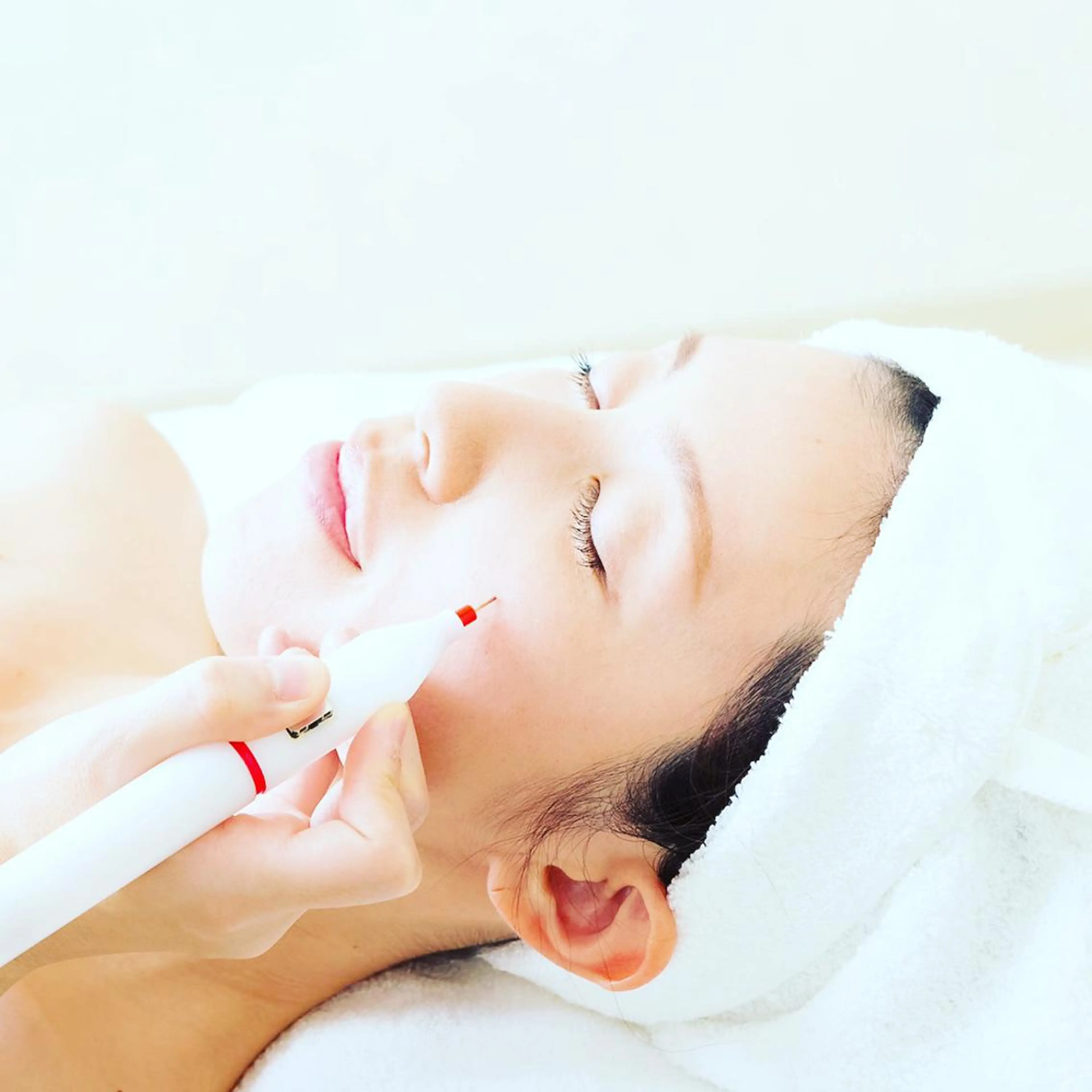 初回限定⭐️シミ取り放題20分　11000円の写真