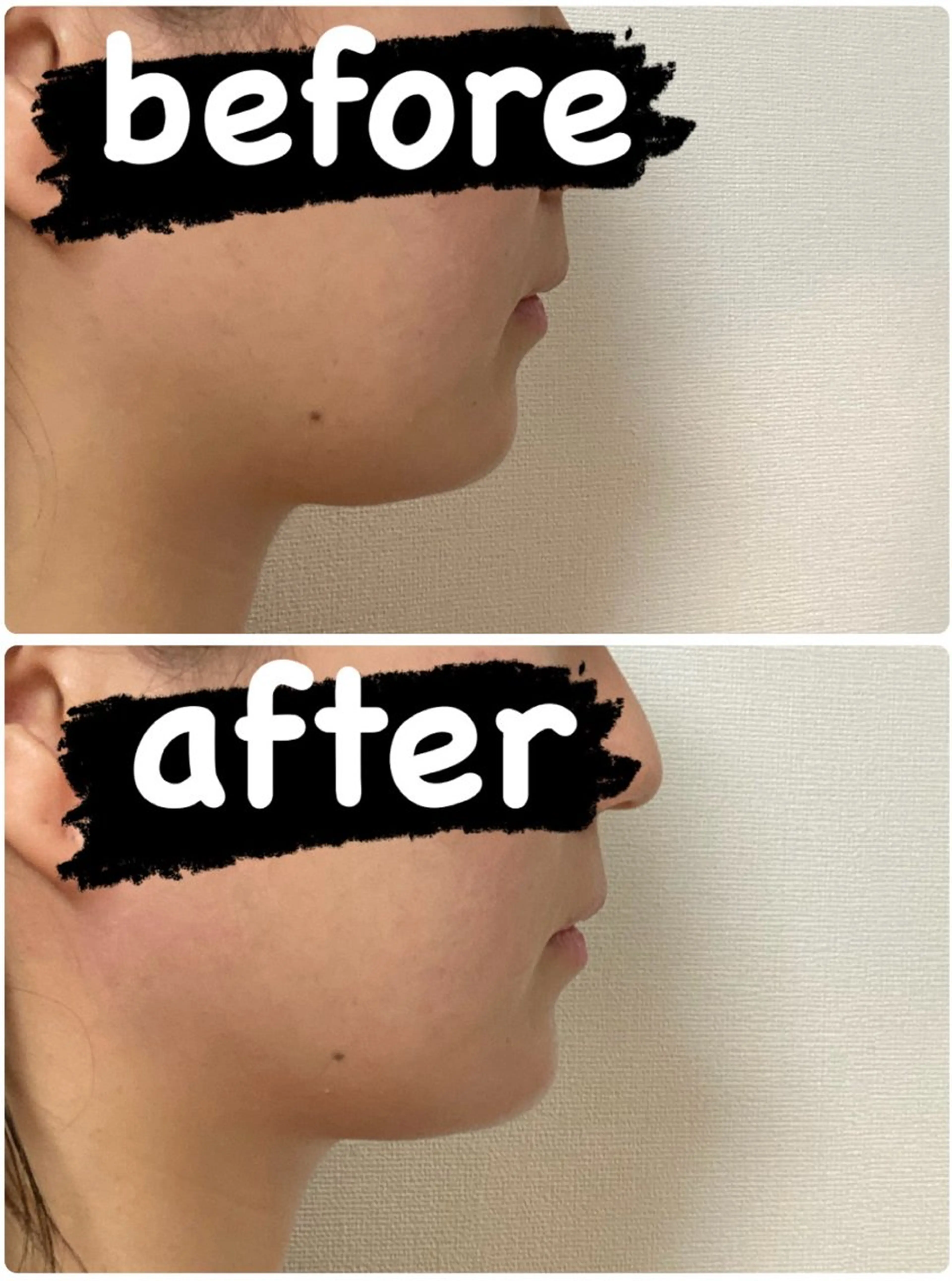 【痩身・脱毛サロン】 REBISKIN🌱のエステ・リラクイメージ