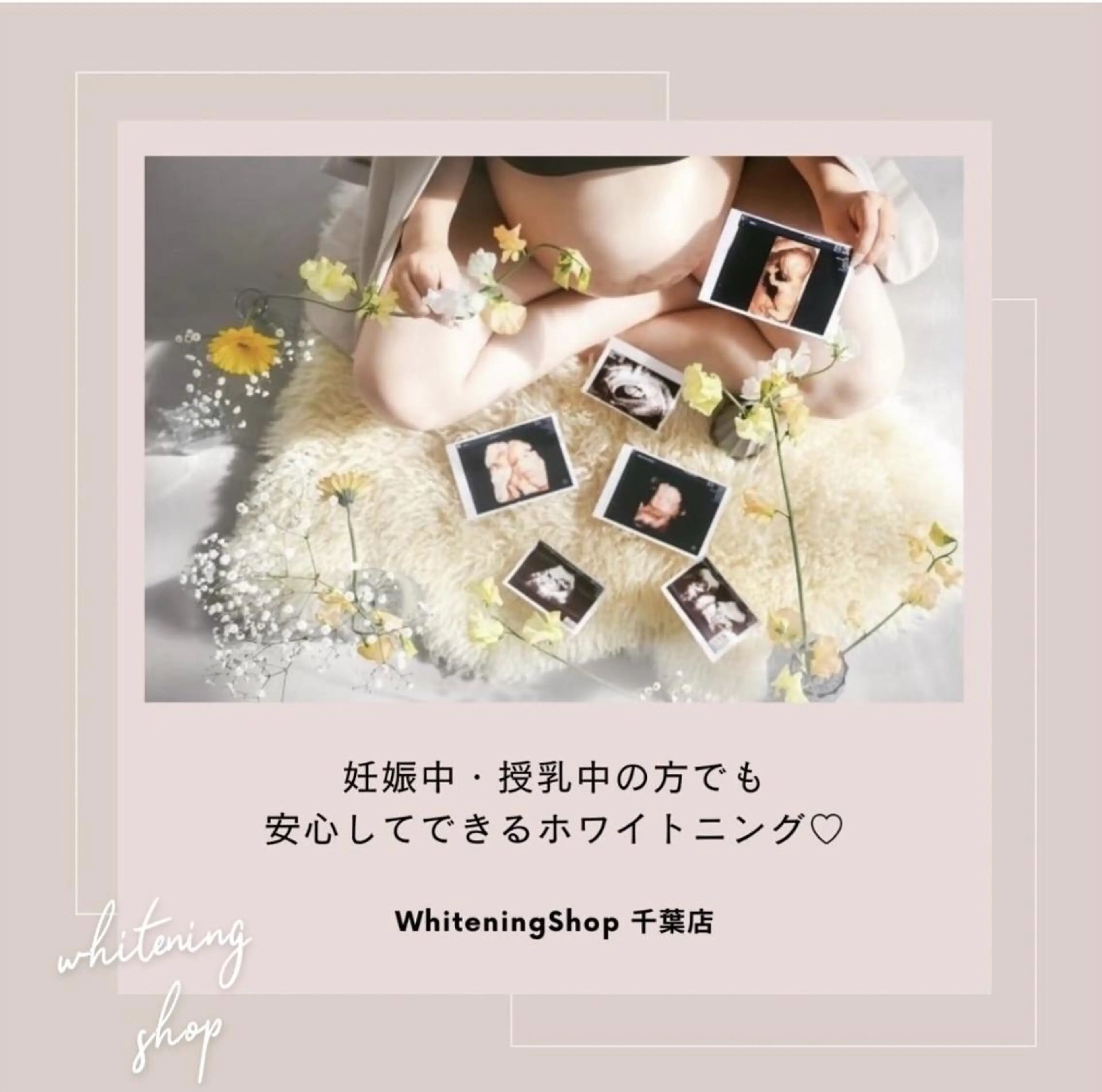 メンズ その他 ホワイトニング ショップ千葉店のその他イメージ