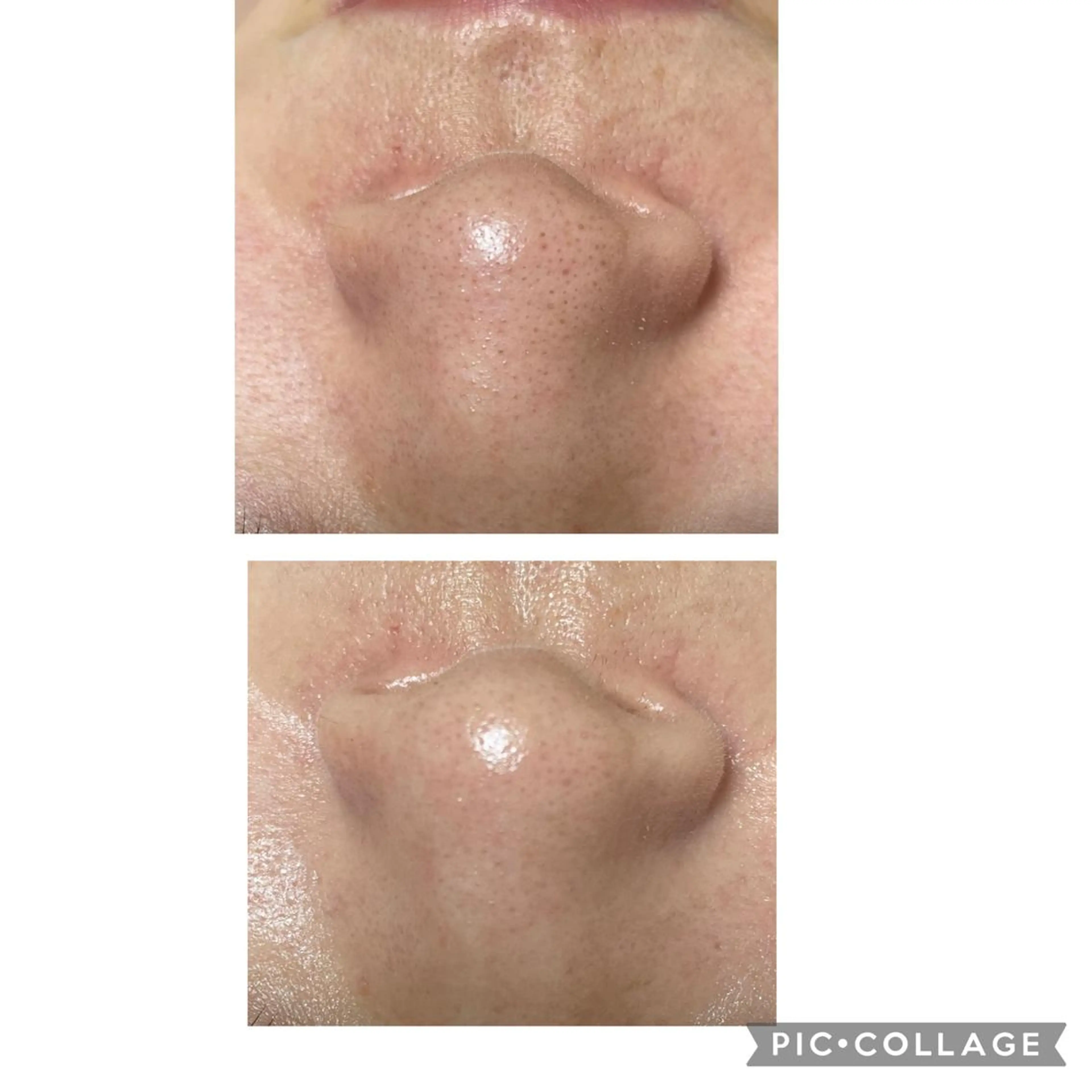 エステ 伊藤 順子のその他イメージ