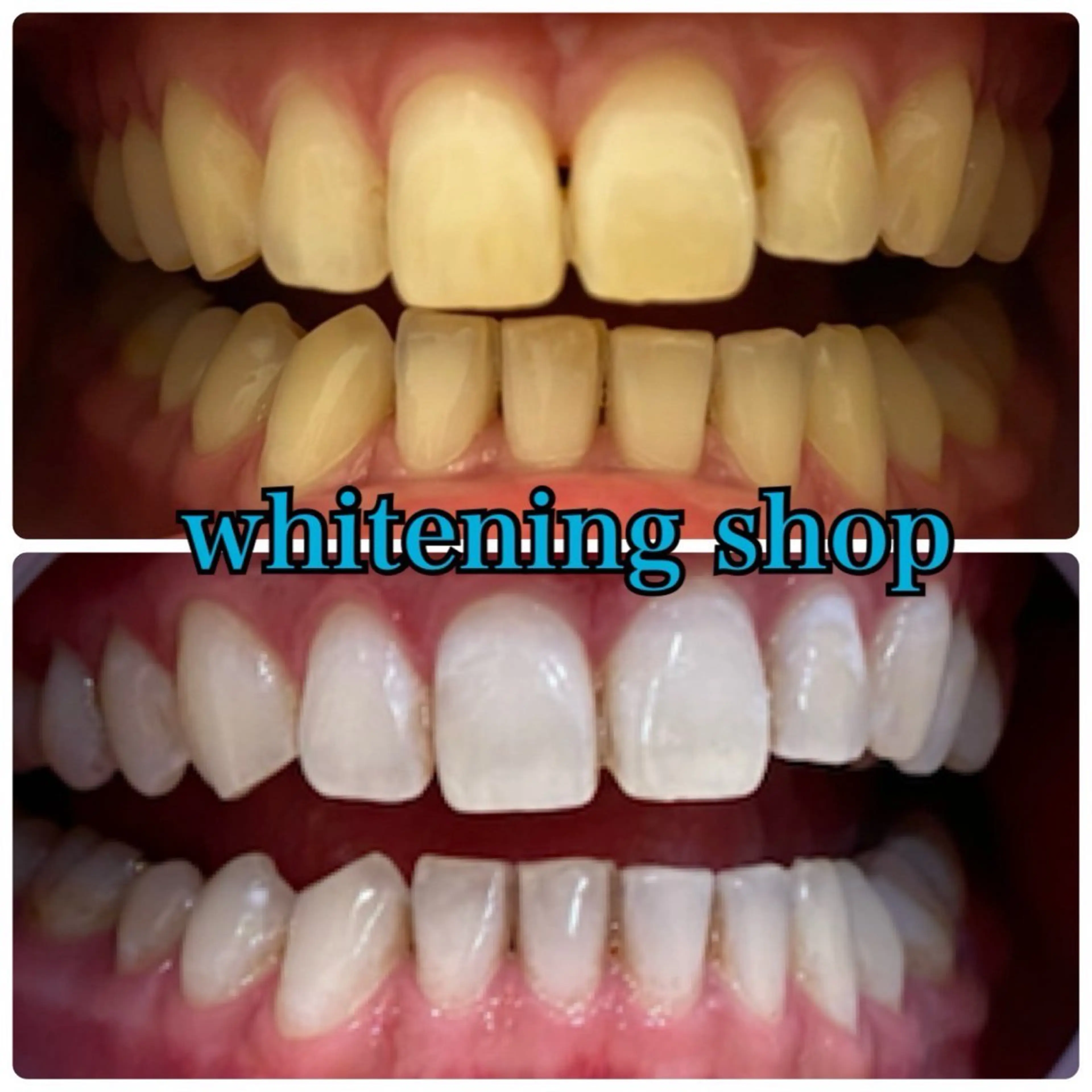 メンズ エステ リラク ホワイトニング ショップ川越店のエステ・リラクイメージ