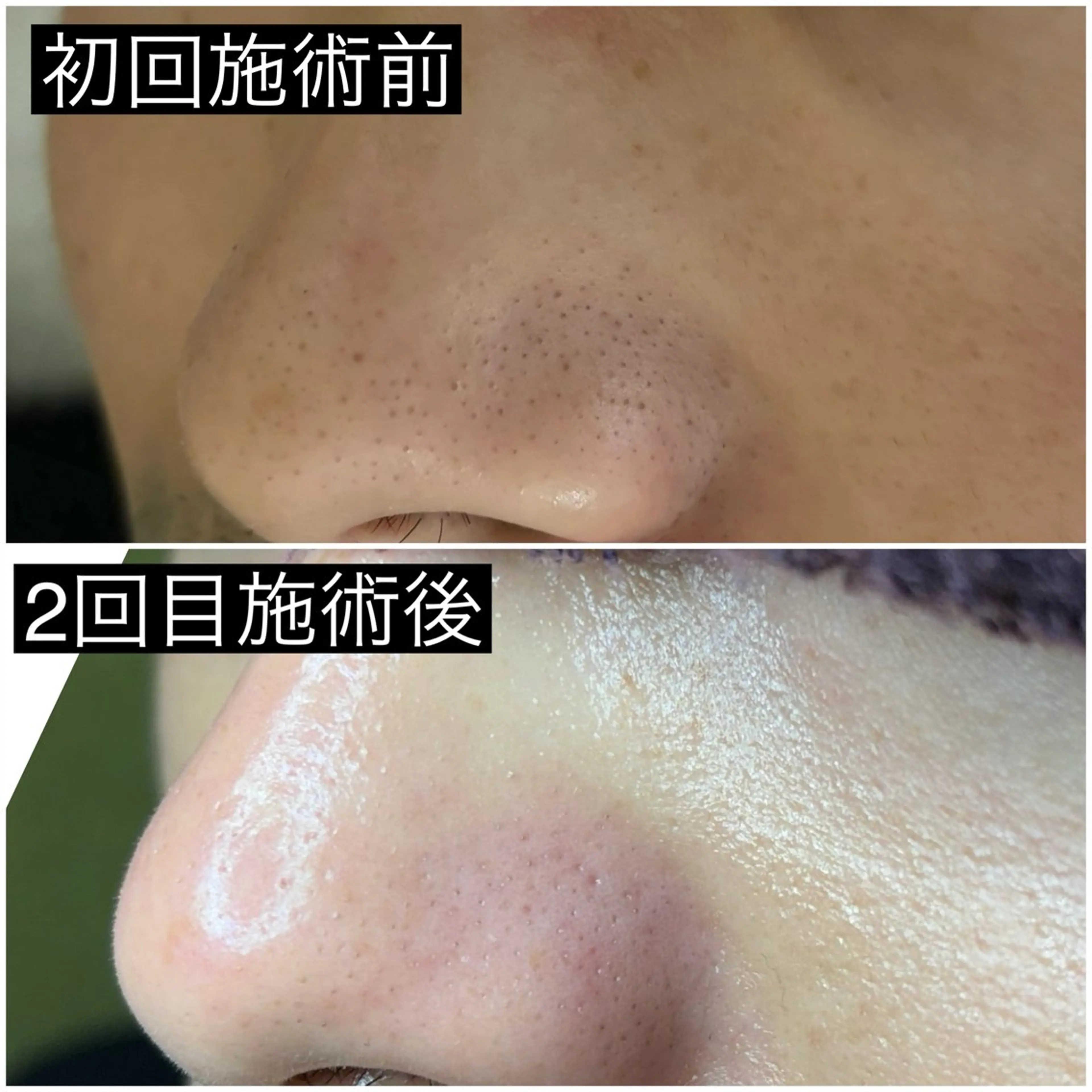 Luralïy hair kitakyushu所属・Luralïy ルーラリーのエステ・リラクイメージ