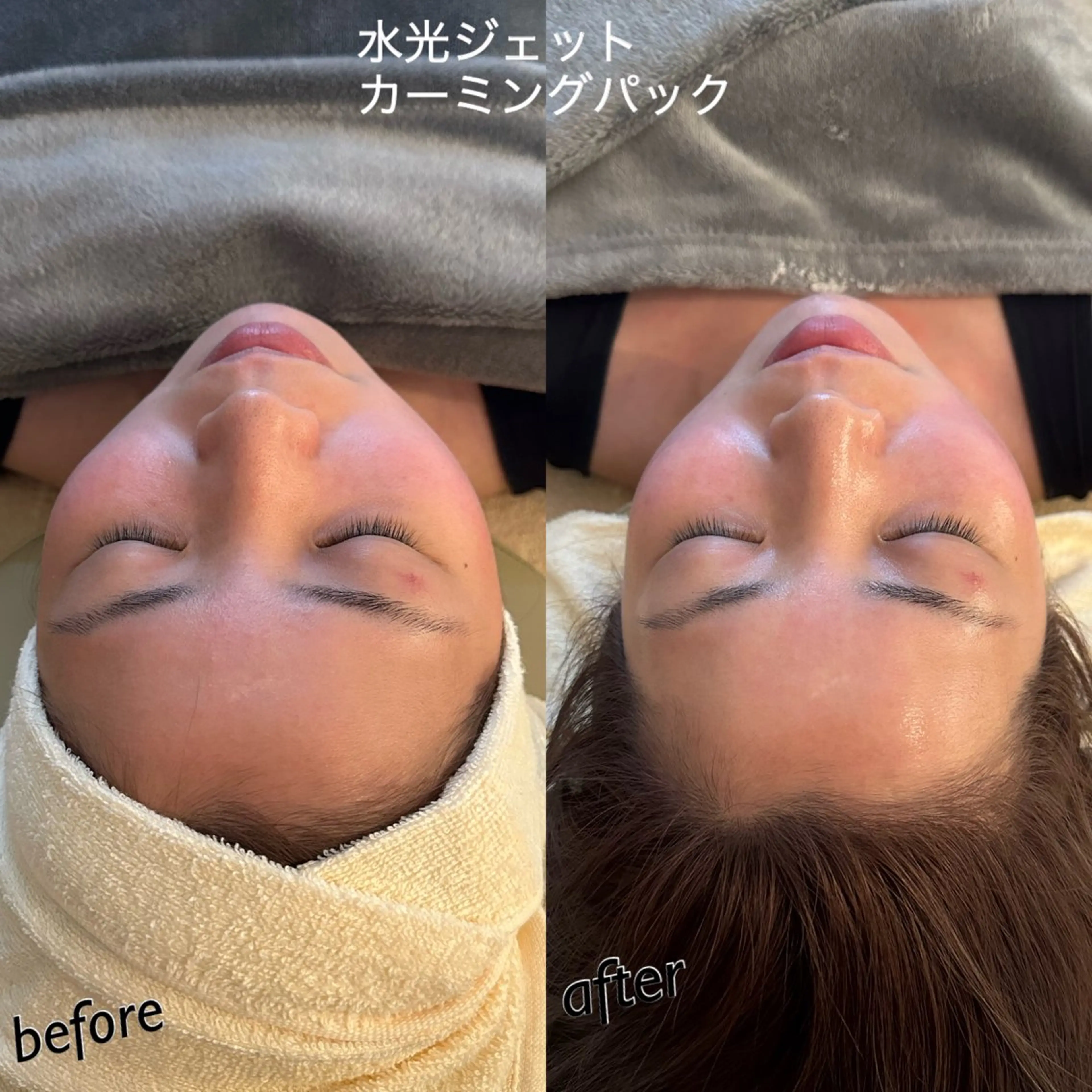 エステ リラク うなじ脱毛/美肌脱毛 LABELのエステ・リラクイメージ