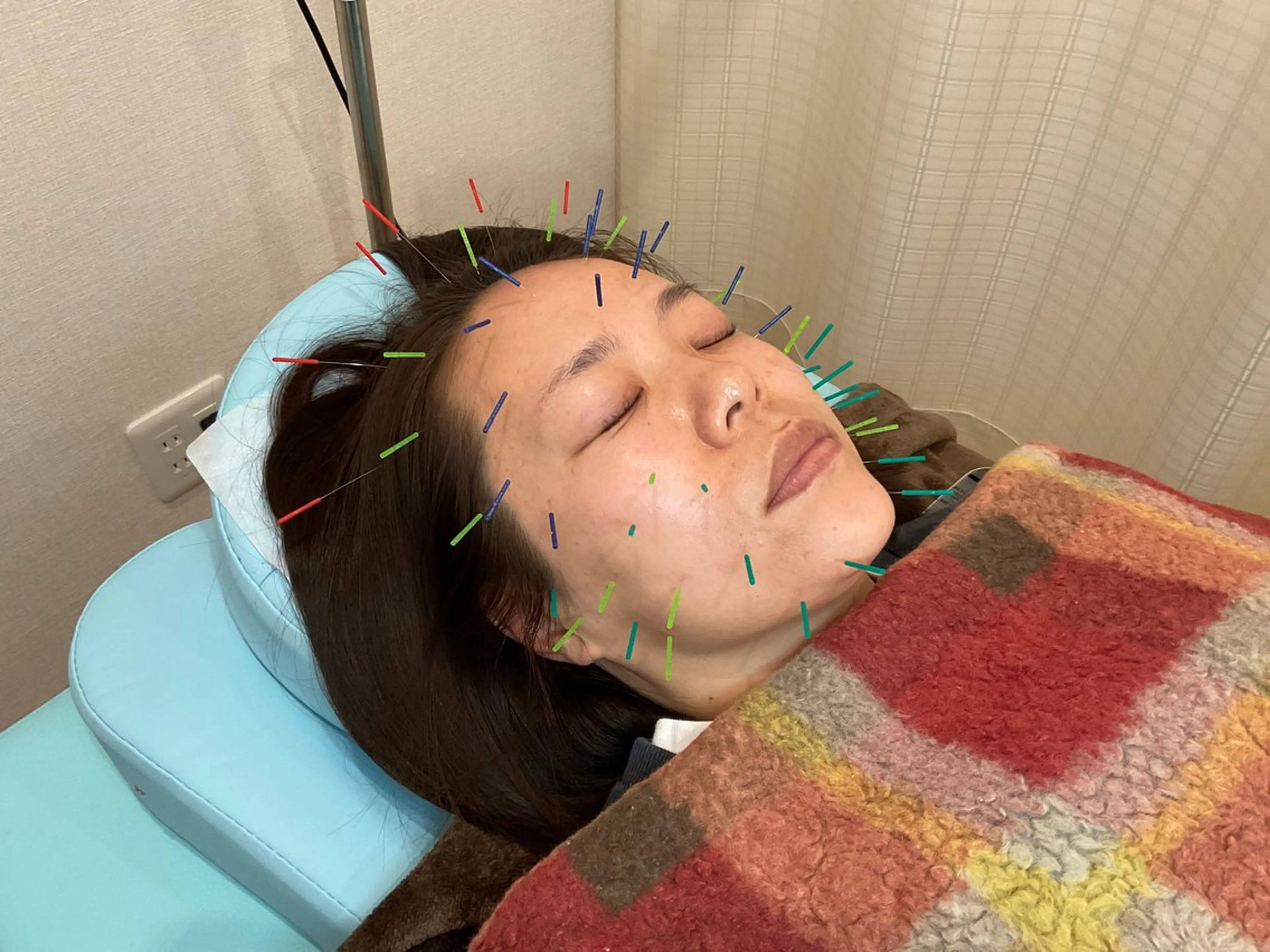 エステ リラク けい整骨院・鍼灸院所属・けい整骨院 鍼灸院のその他イメージ