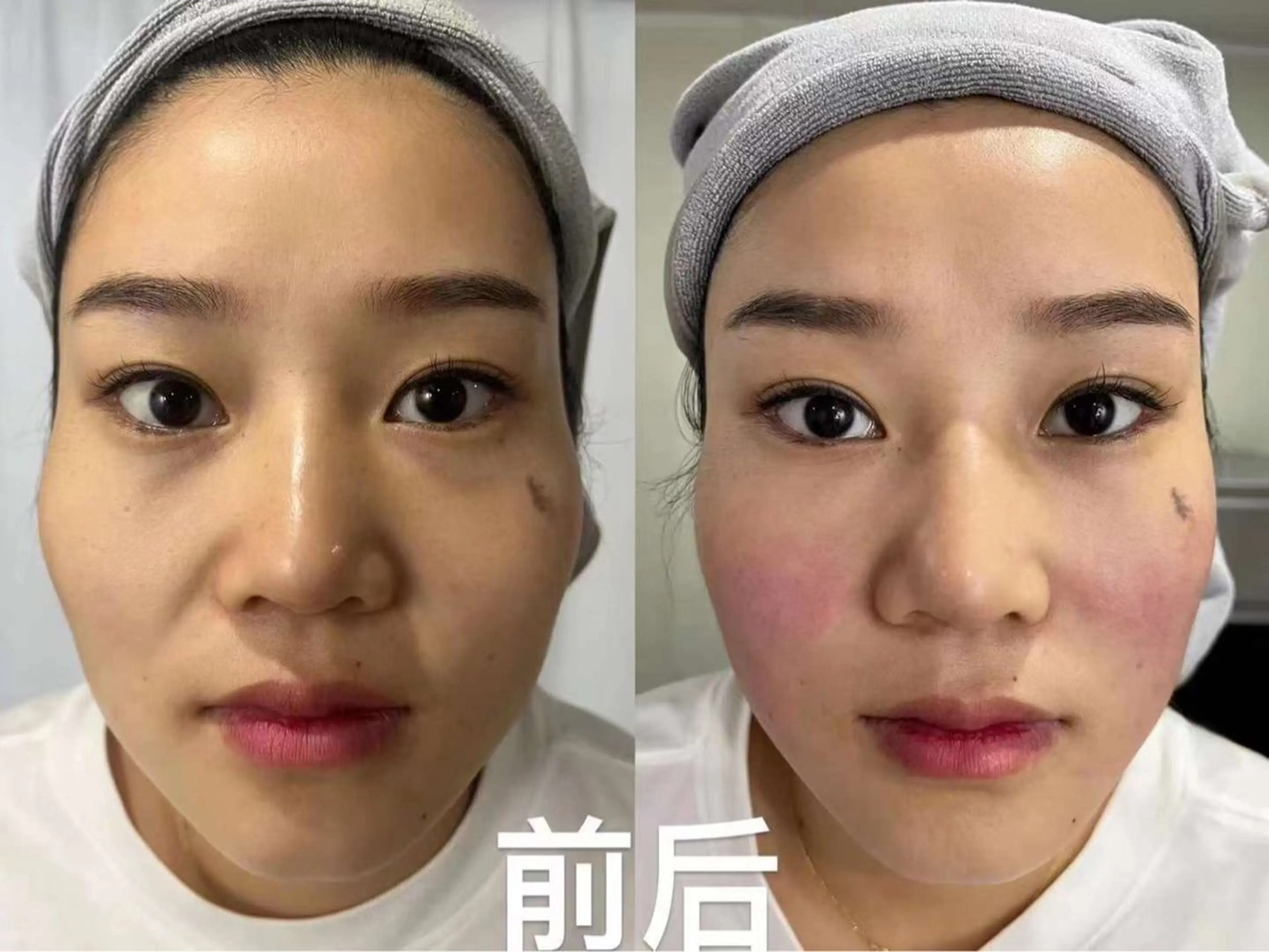 マツエク・マツパ エステ aliaハイフ&水光ジェットサロン所属・aliaハーブ水光店 エステティシャン募集のエステ・リラクイメージ