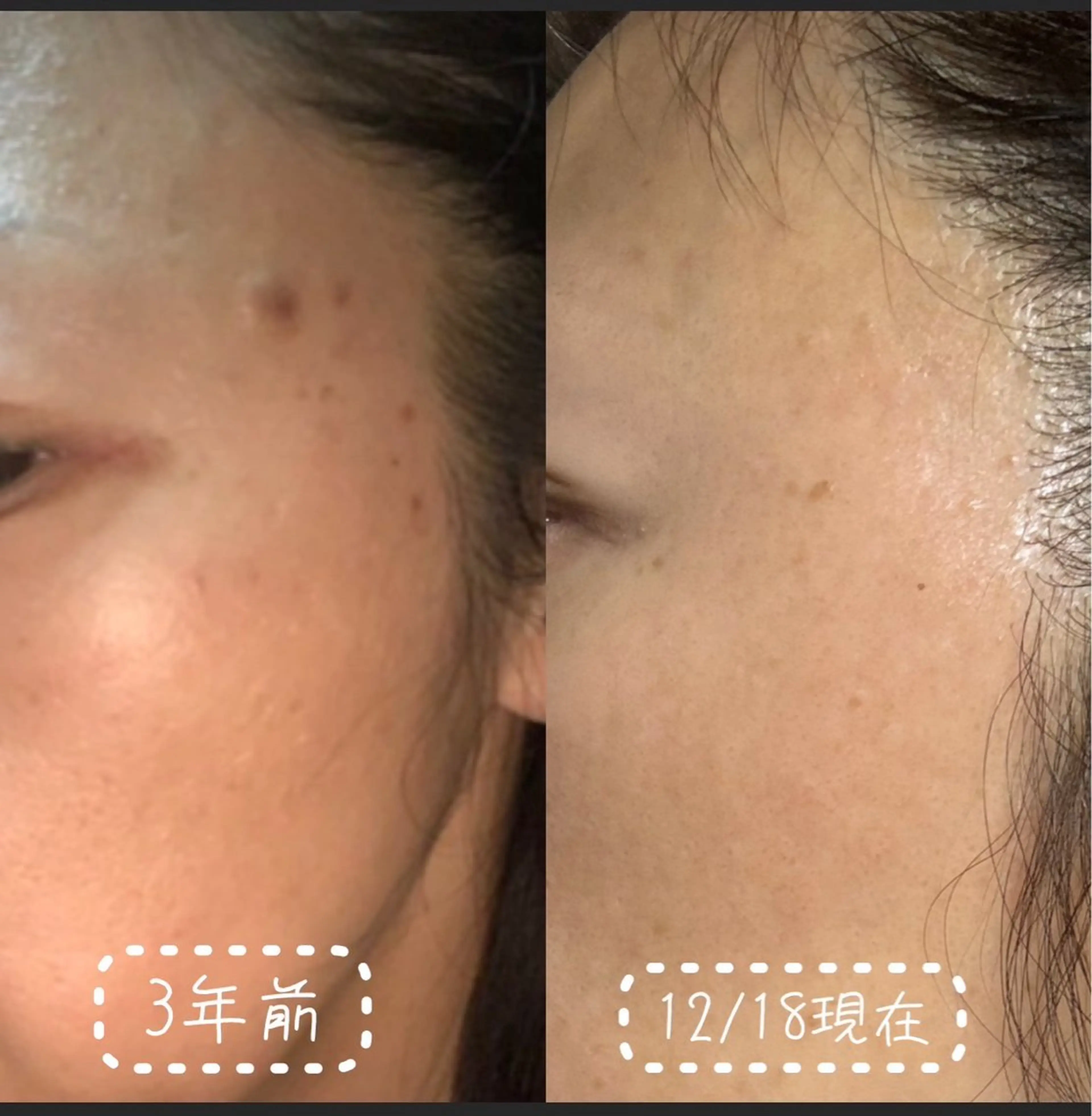 エステ リラク 透明感の肌Lino malieのエステ・リラクイメージ