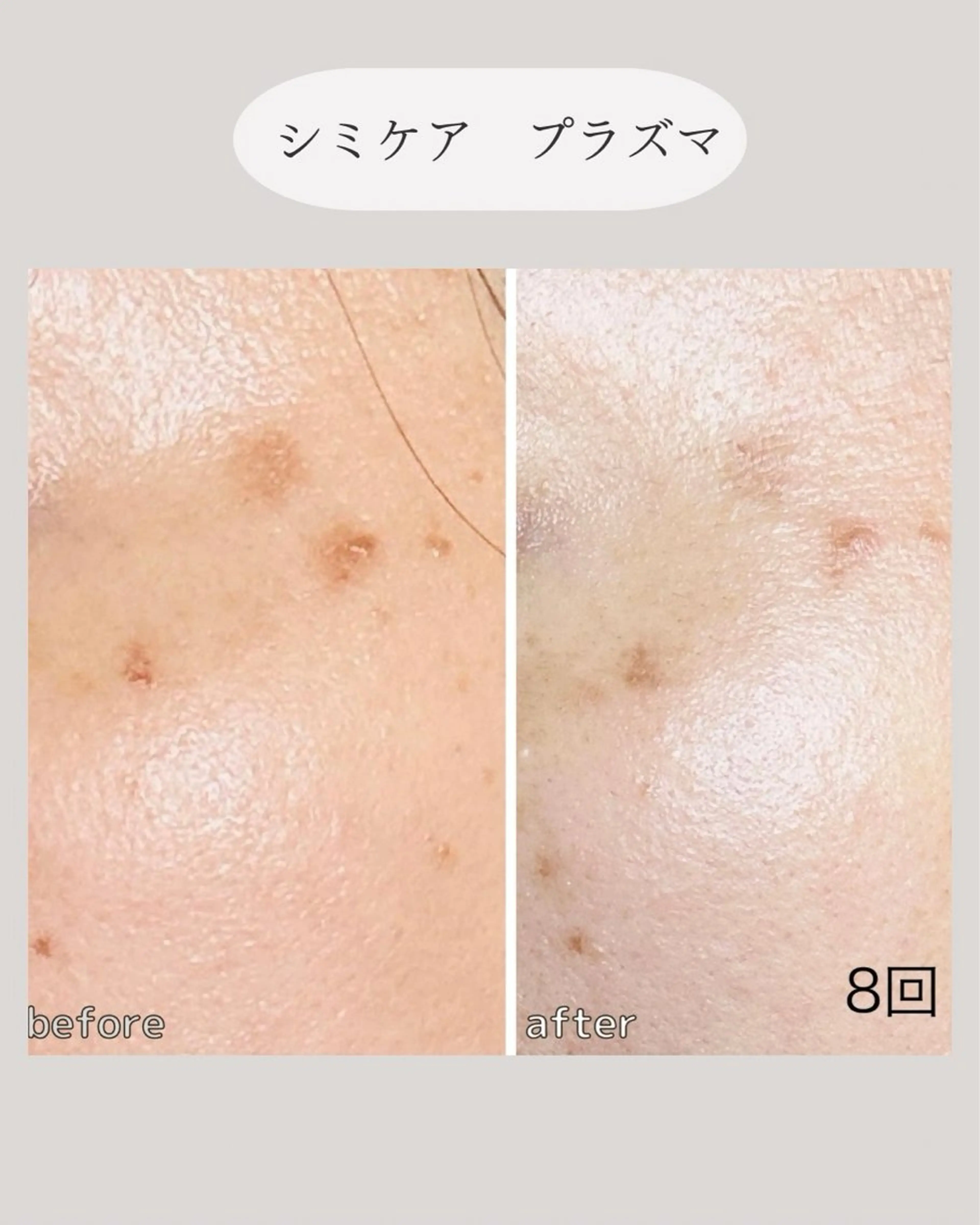 NICORI　小顔&肌質改善専門店所属・小顔＆肌質改善 NICORIのエステ・リラクイメージ