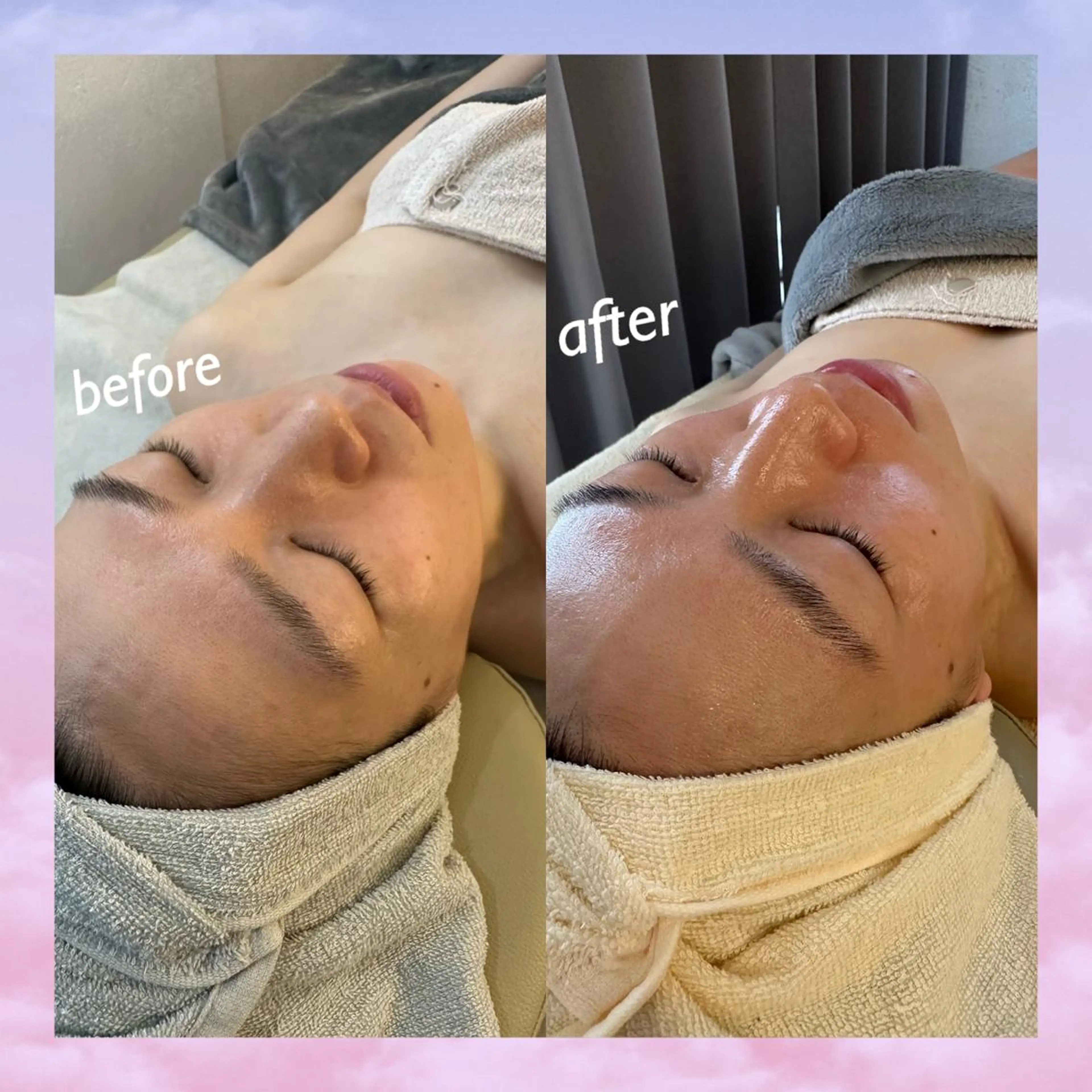 エステ うなじ脱毛/美肌脱毛 LABELのエステ・リラクイメージ