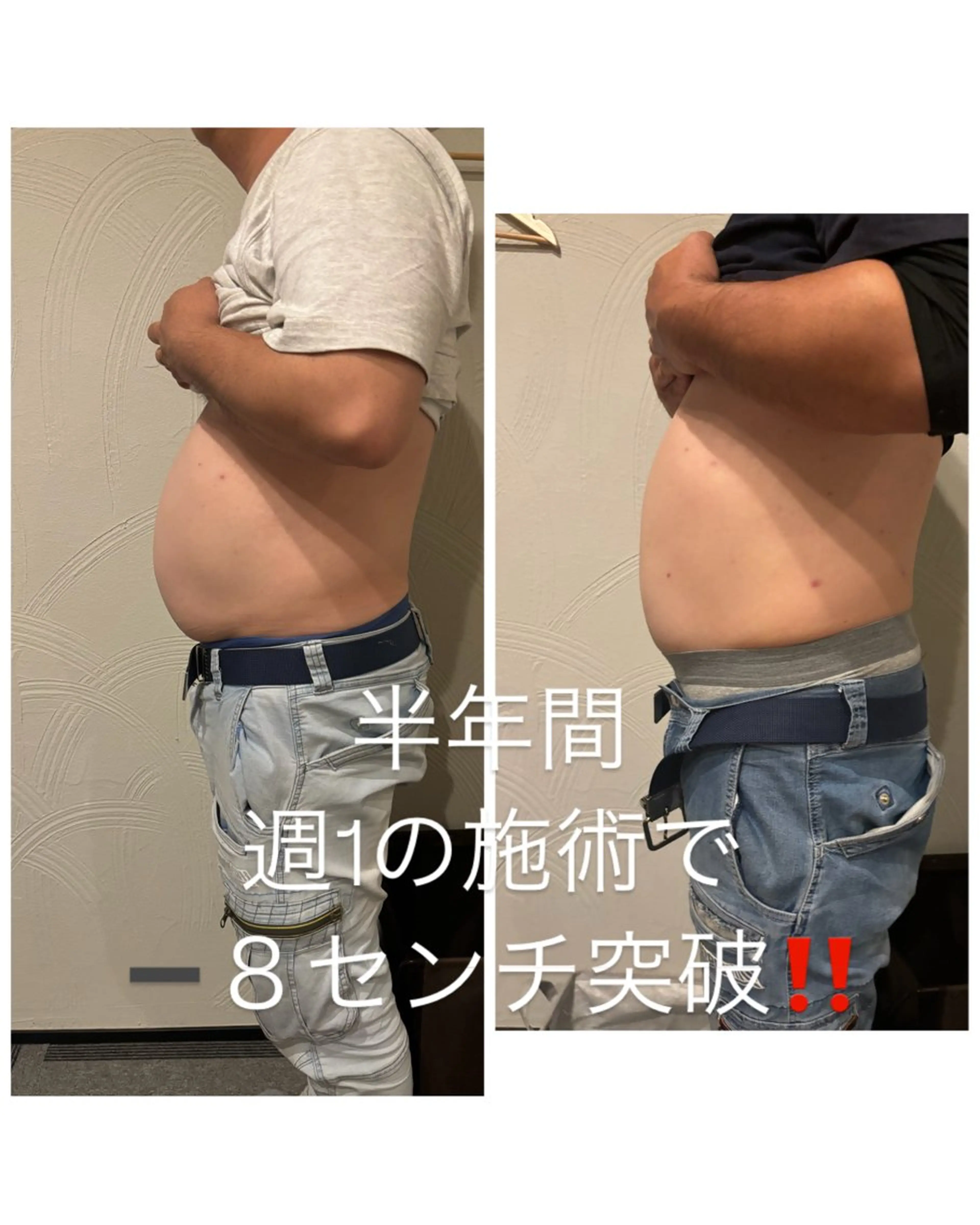 JUMBO接骨院× まいぺ〜す♪のエステ・リラクイメージ