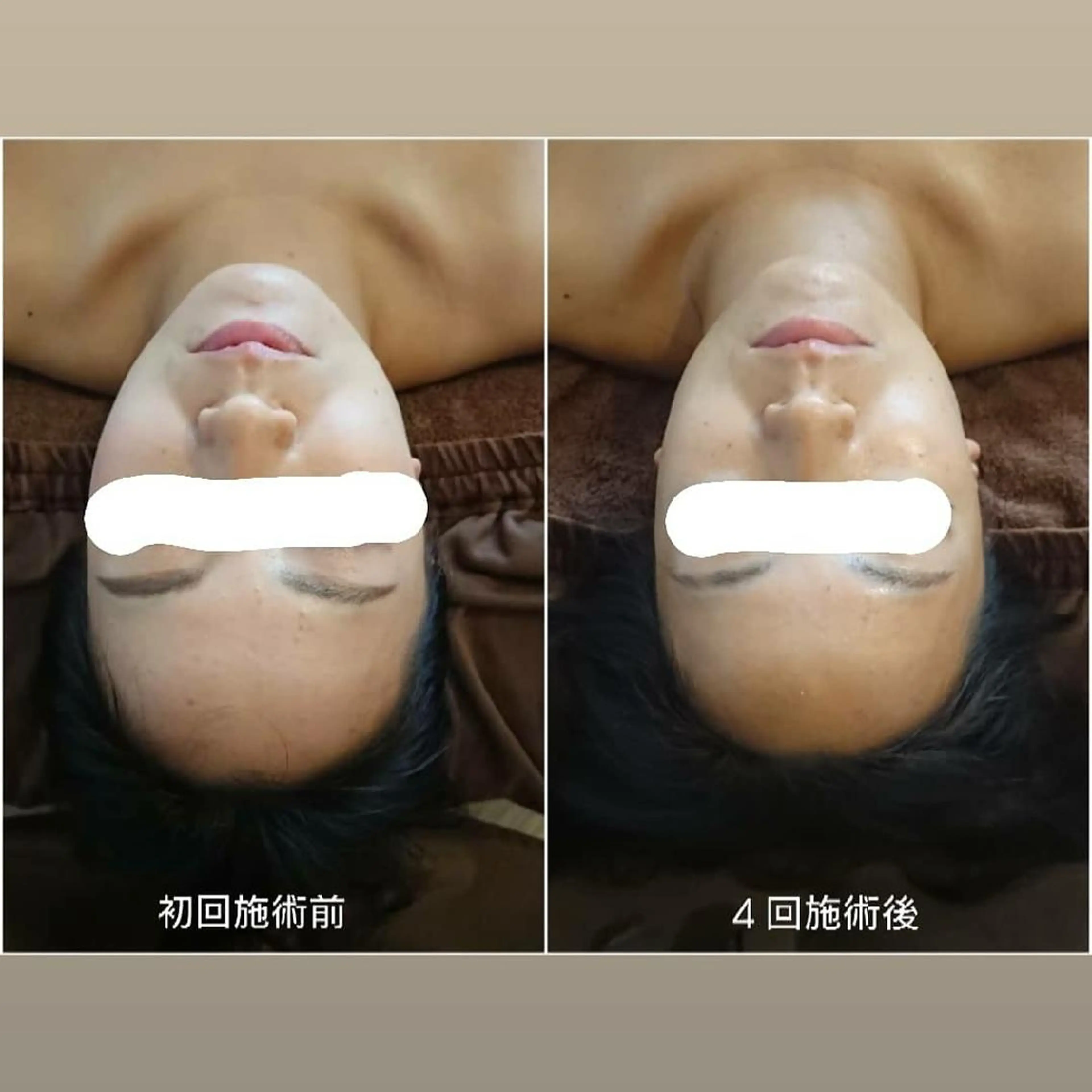 Jeliss~美爪育成ネイル＆頭蓋骨小顔矯正サロン~所属・美顔(小顔)矯正& 美爪育成Jelissのエステ・リラクイメージ