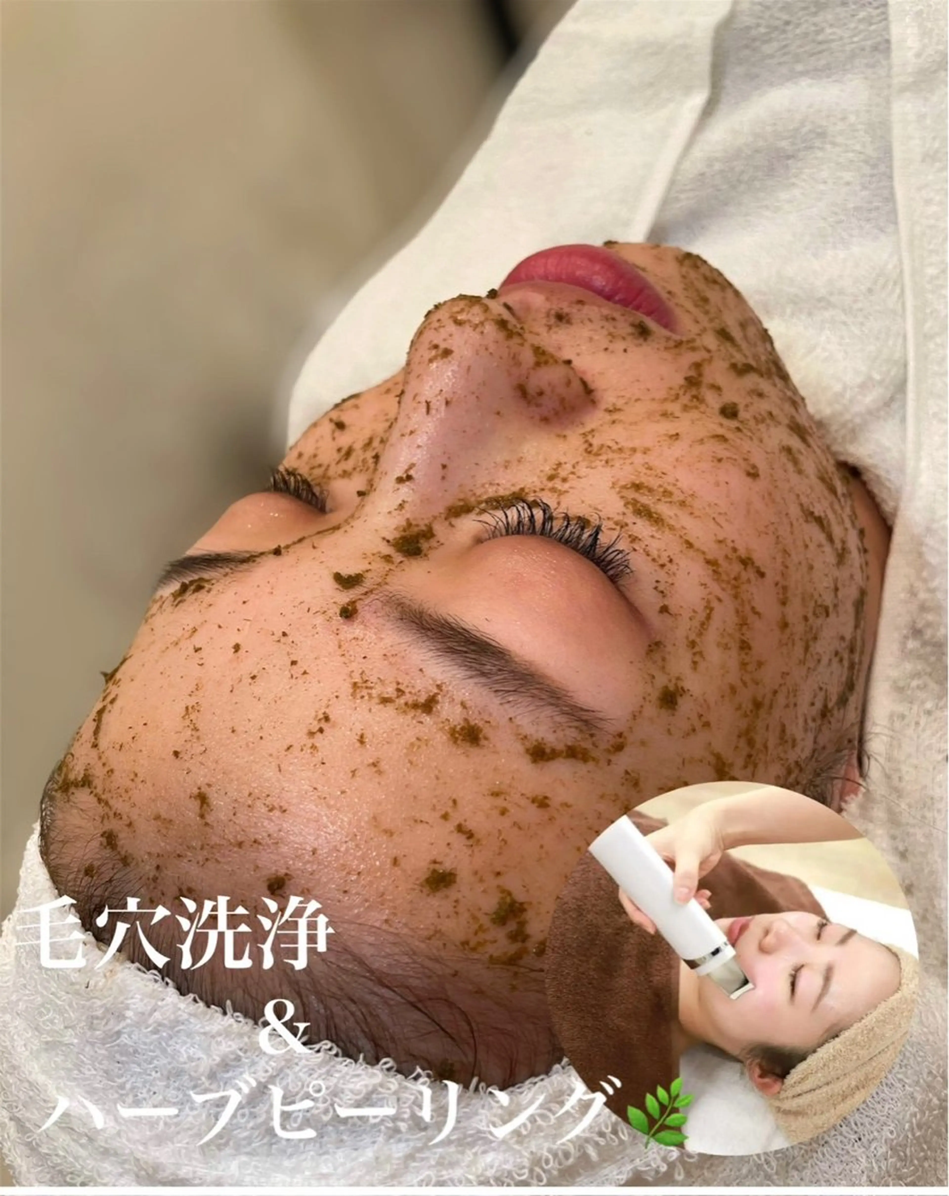 【人気No1☆】塗る金の糸”☆ハーブピーリング+超音波毛穴洗浄☆の写真