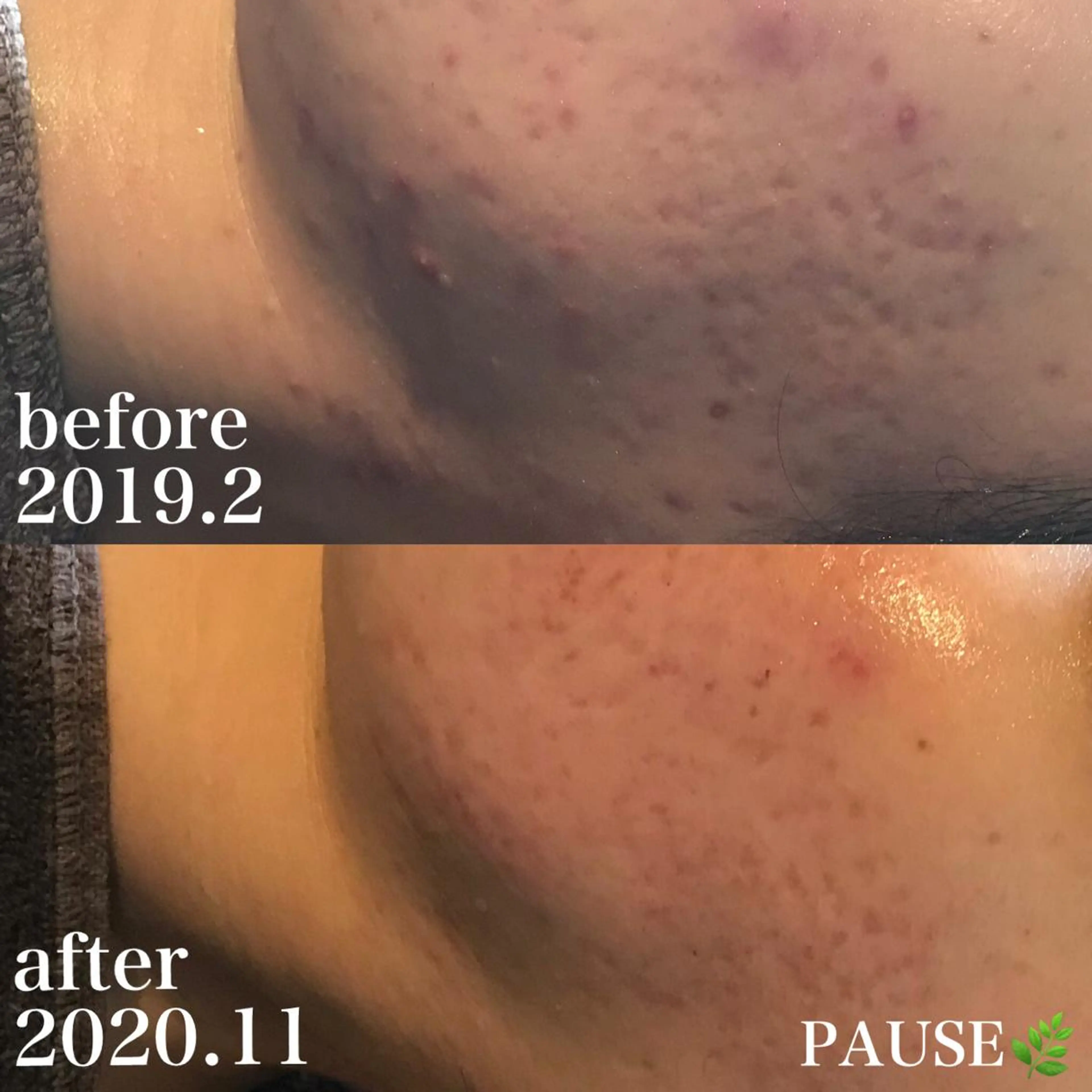 エステ 浜野 恵美のエステ・リラクイメージ