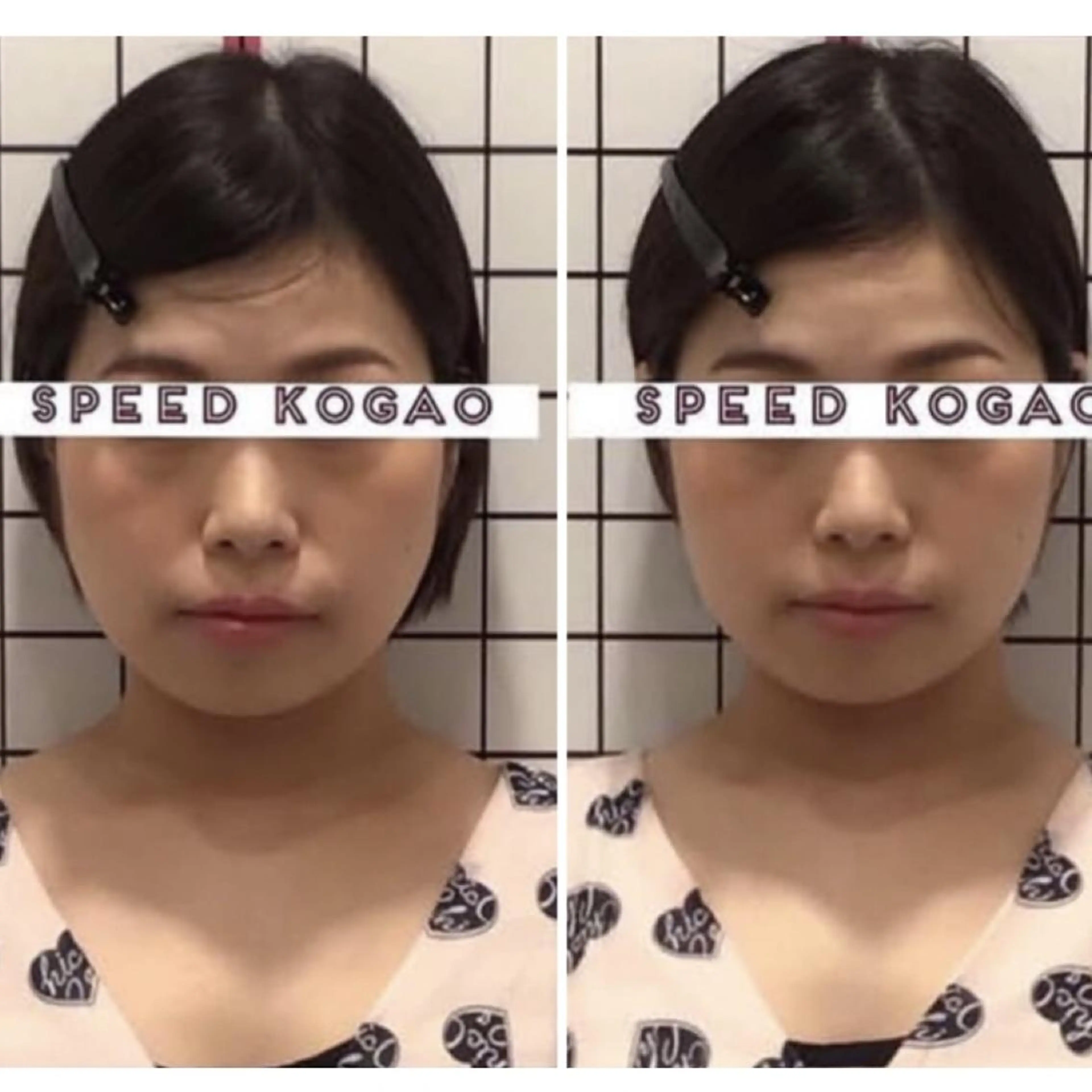 エステ 小顔矯正 natsuのエステ・リラクイメージ