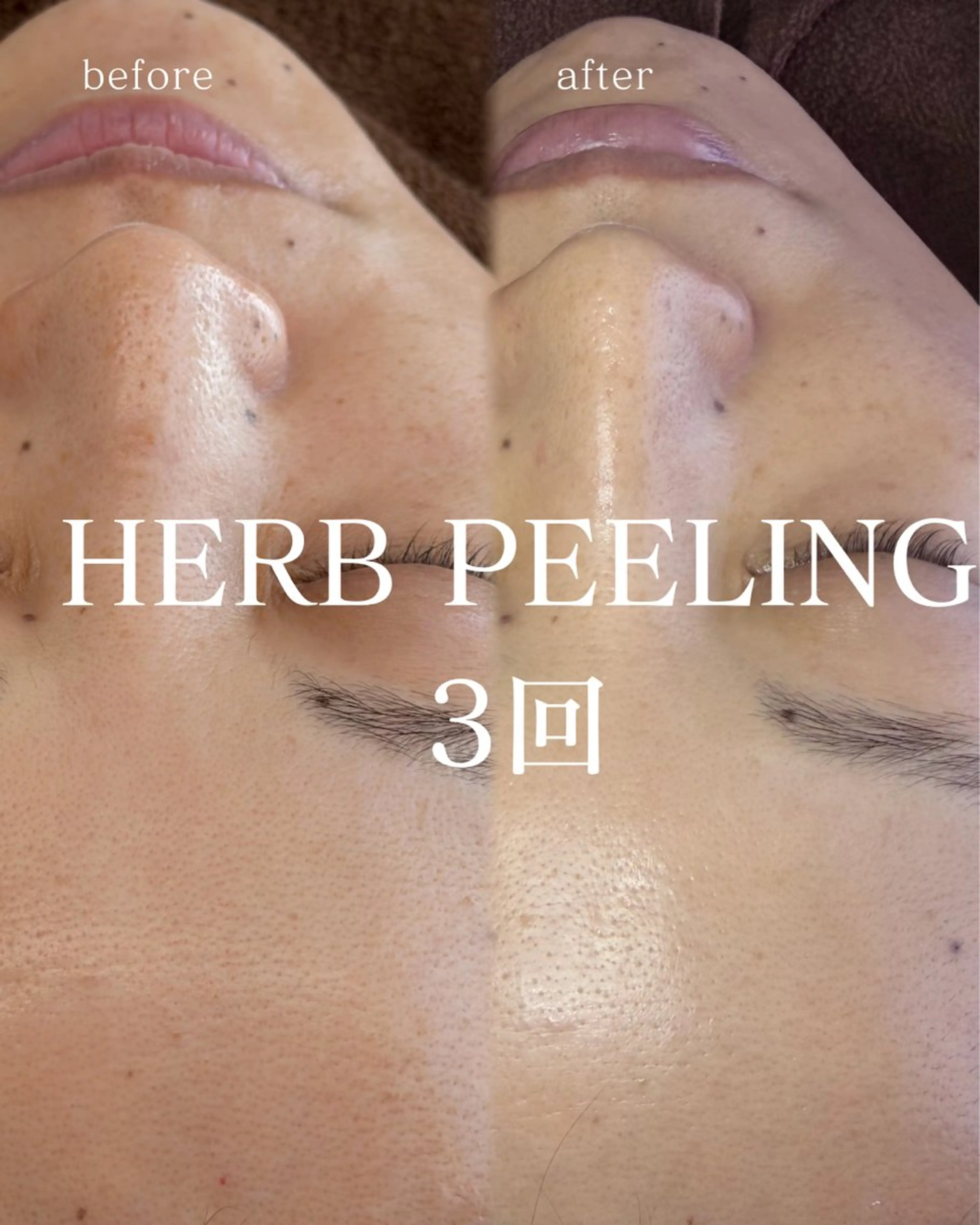 câlin所属・calin エステ/まつ毛/眉毛の眉毛・アイブロウイメージ