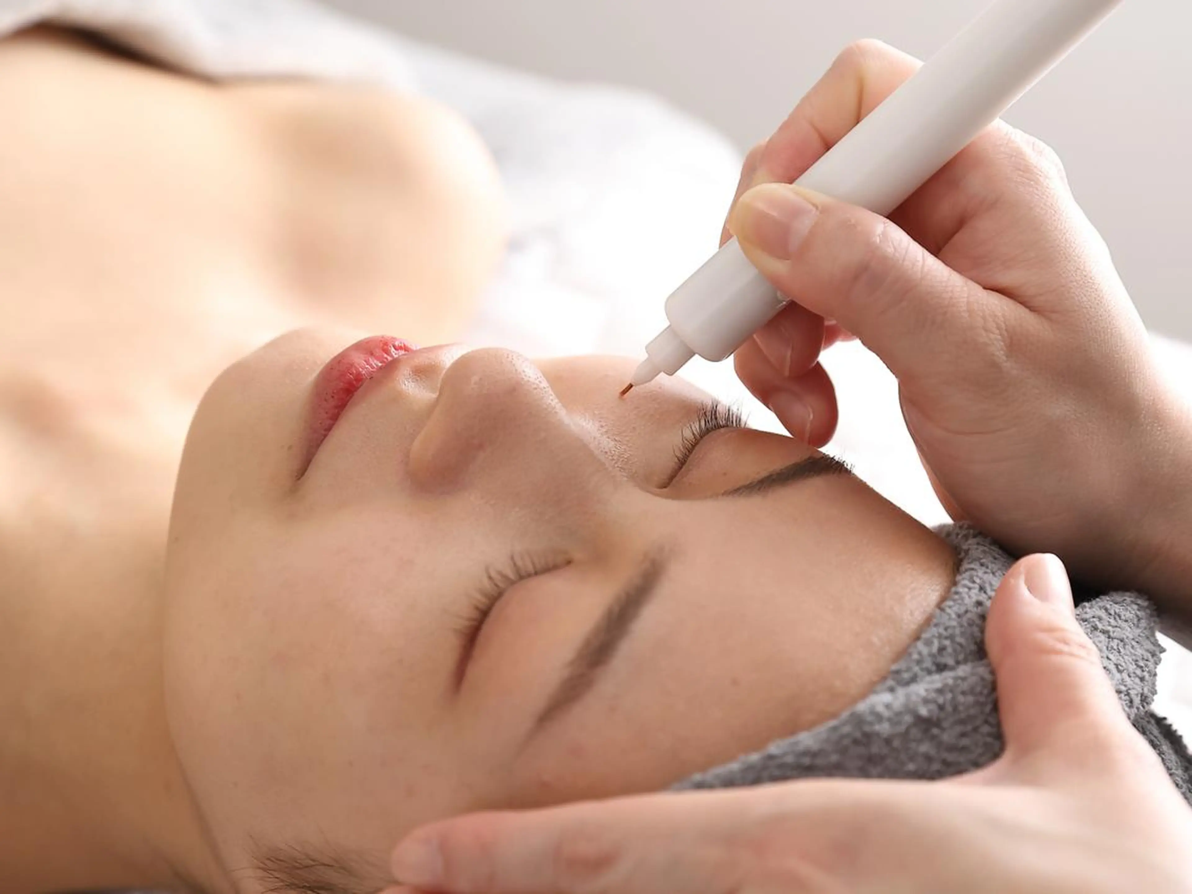 シミ30分当て放題お試しコース（部分クレンジング）の写真