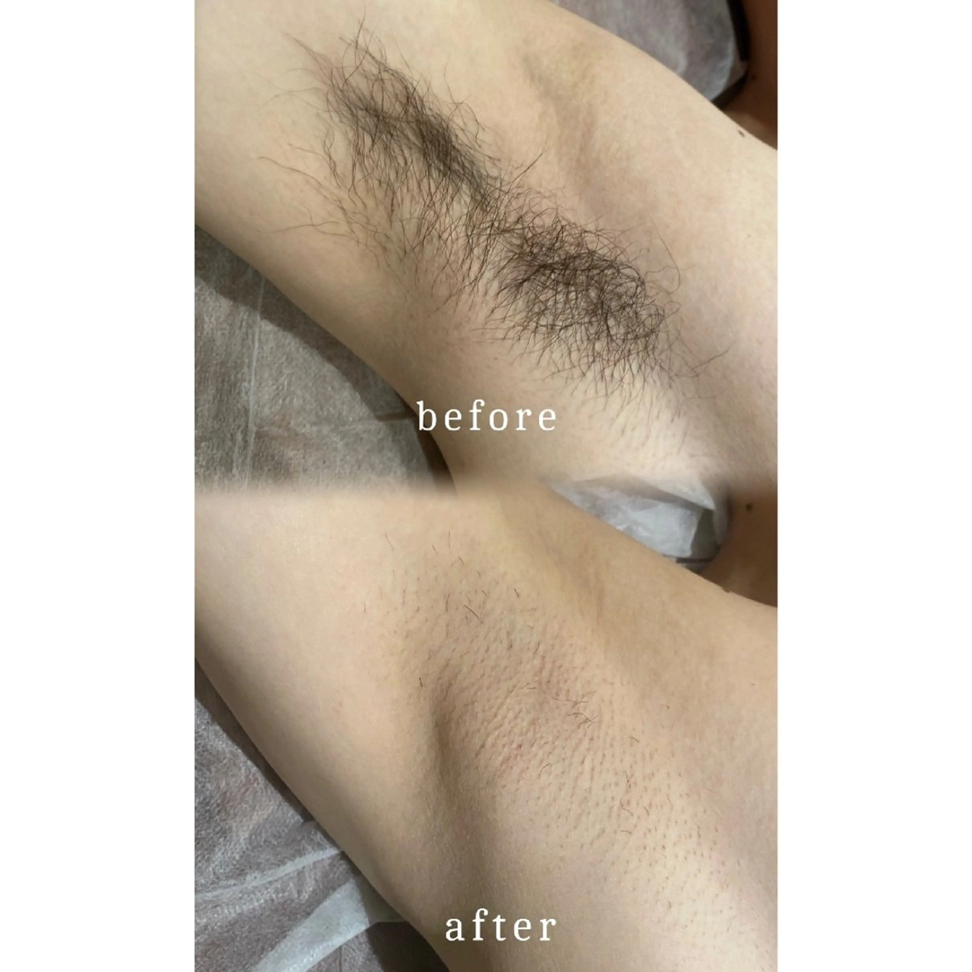 メルシー13所属・トータル美容サロン☆ 脱毛/小顔/毛穴洗浄のエステ・リラクイメージ