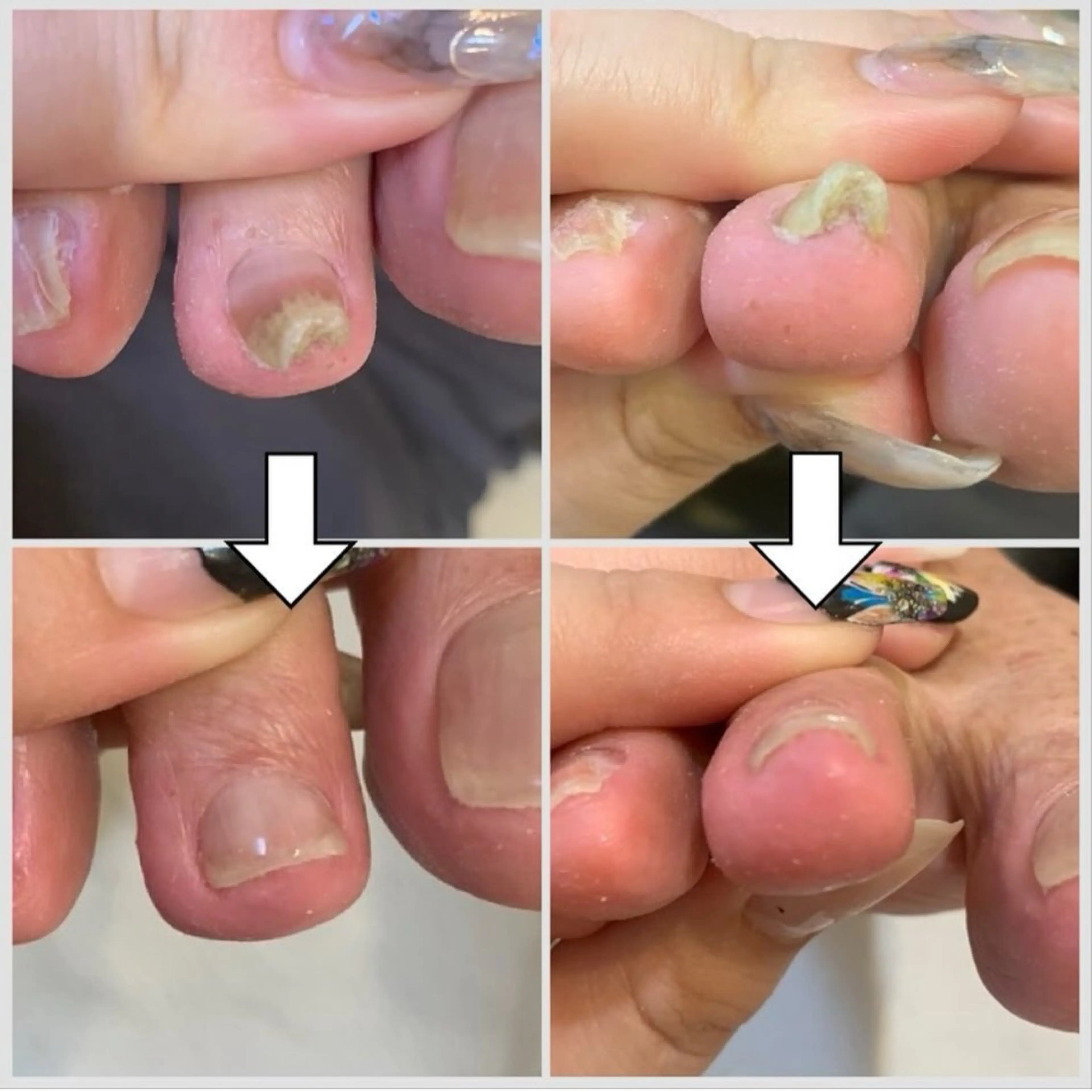 ネイル ネイルサロンailes所属・ネイルサロンエール 店長沼尻のネイルデザイン