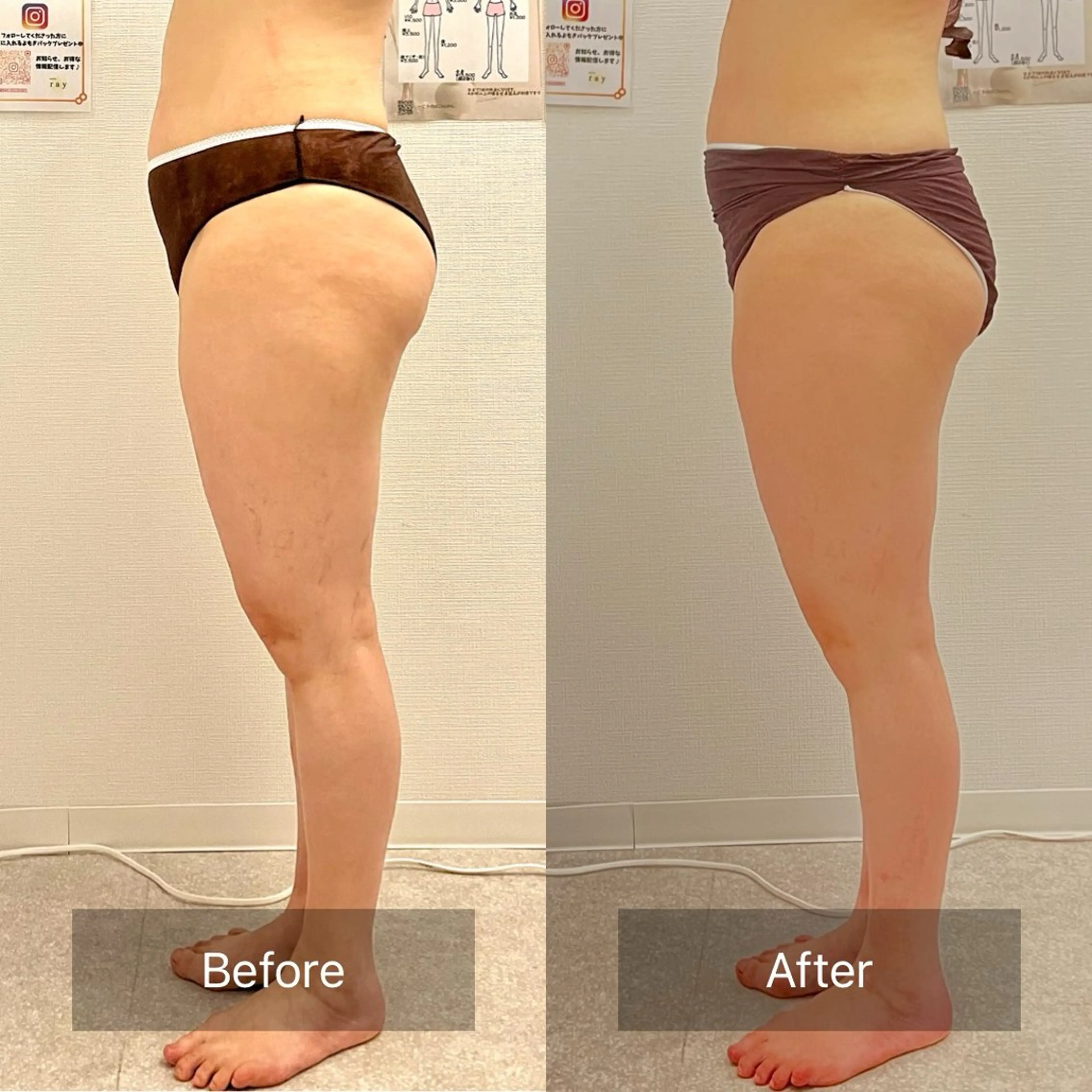 salon ray 痩身／体質改善のエステ・リラクイメージ